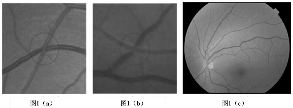 Arteriovenous cross compression symptom detection method and device, electronic equipment and readable storage medium