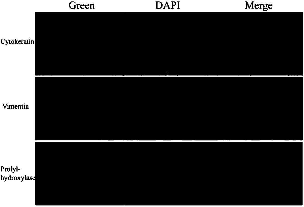 Method for constructing 3D model in vitro of colon cancer cell peritoneal metastasis