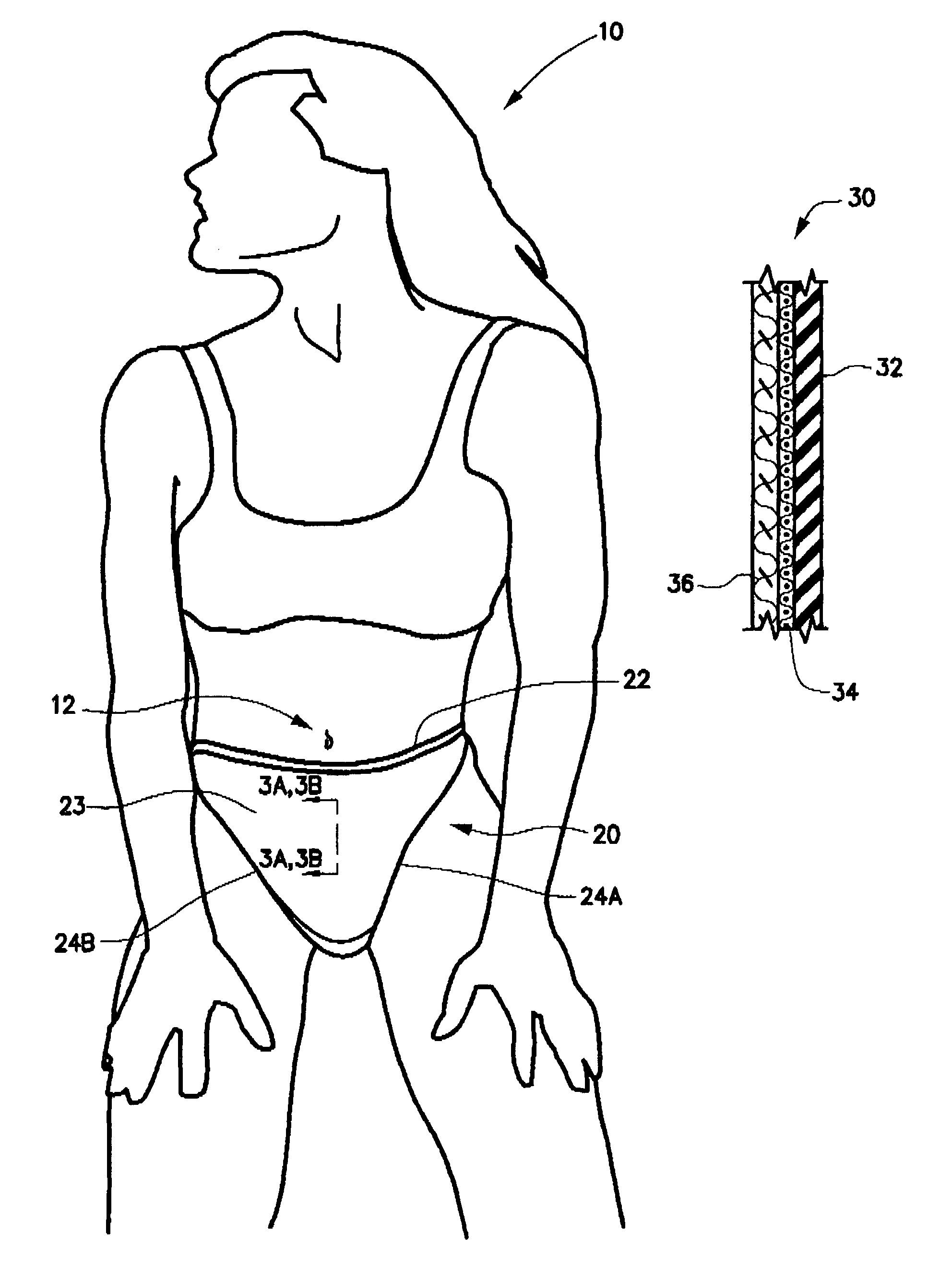 Post-cesarean section scar management undergarment