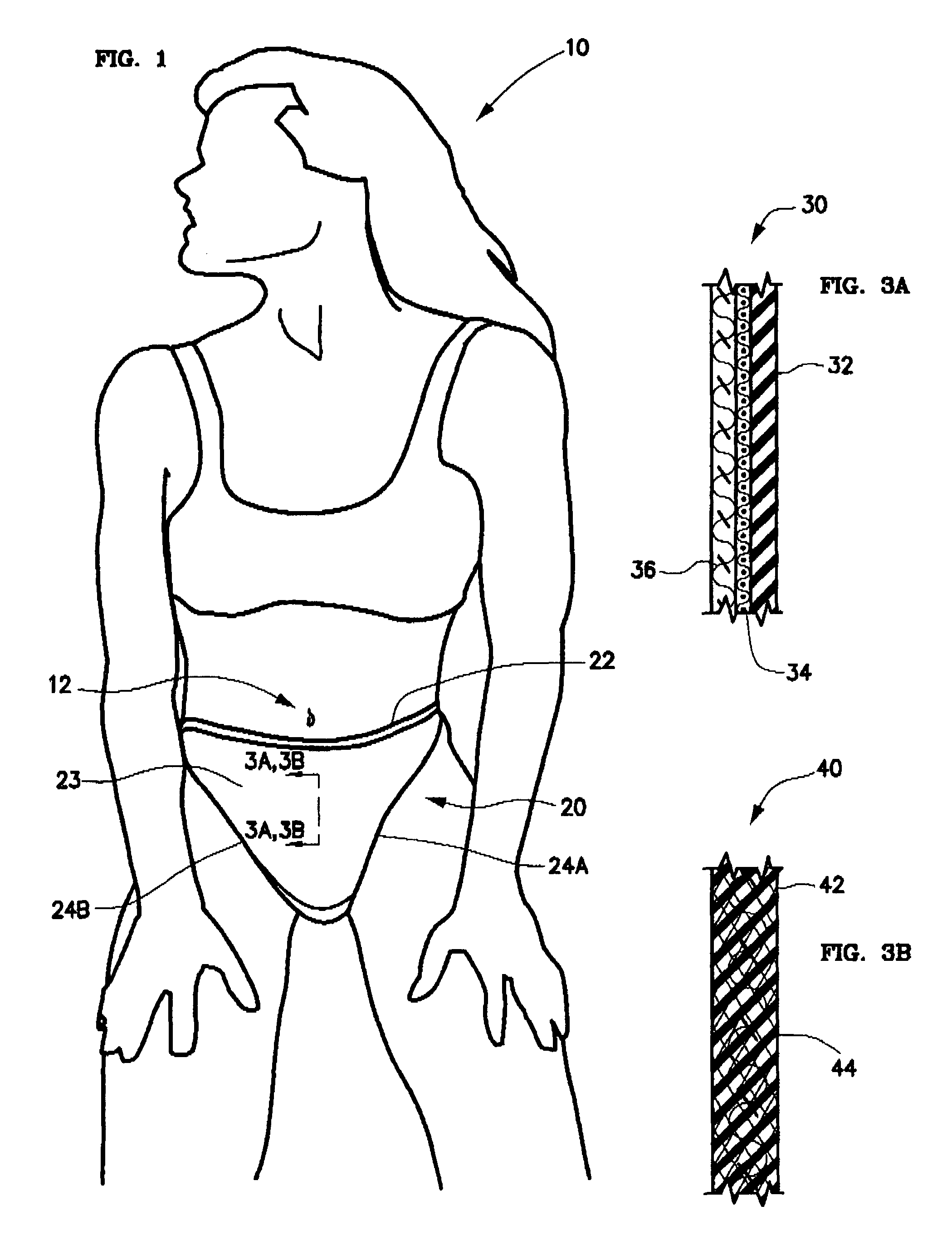 Post-cesarean section scar management undergarment