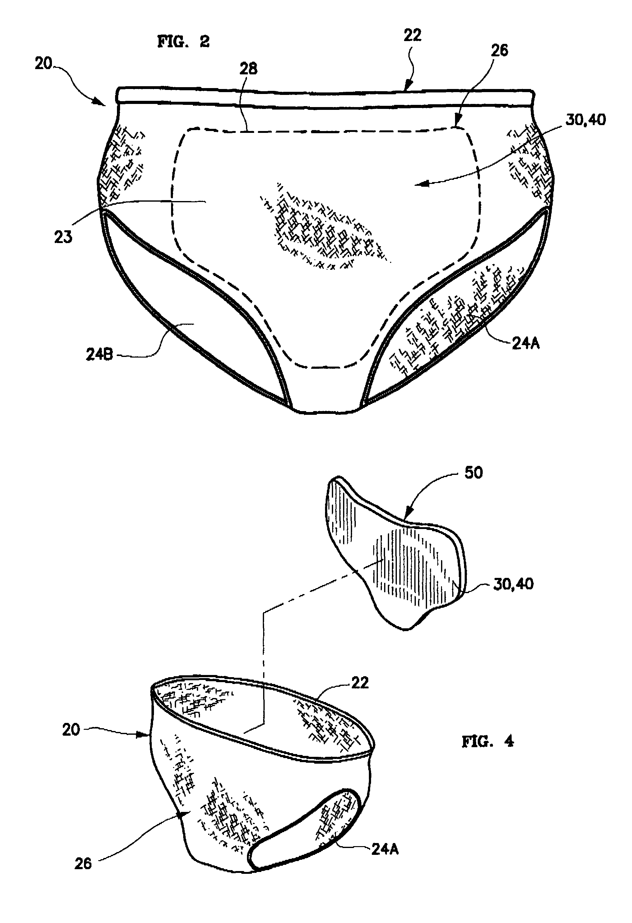 Post-cesarean section scar management undergarment