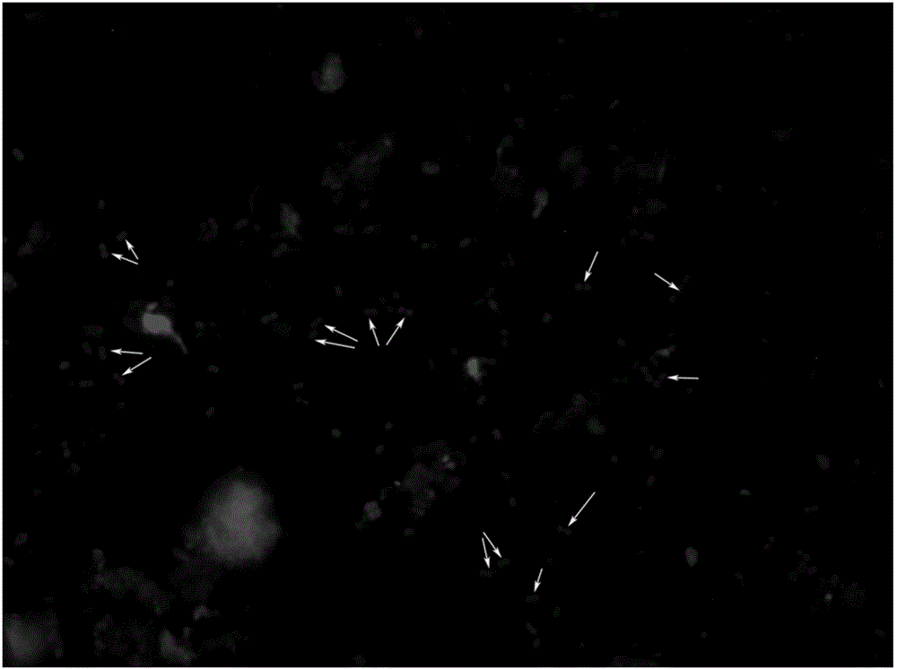 Method for rapidly detecting proteolysis bacteria in human excrement