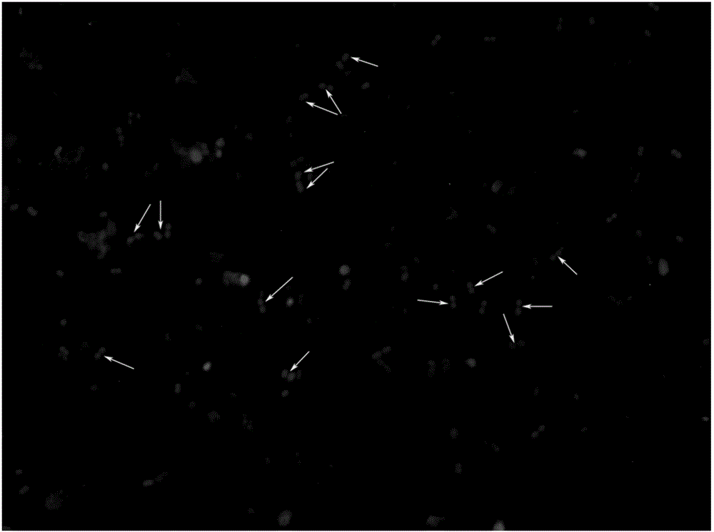 Method for rapidly detecting proteolysis bacteria in human excrement