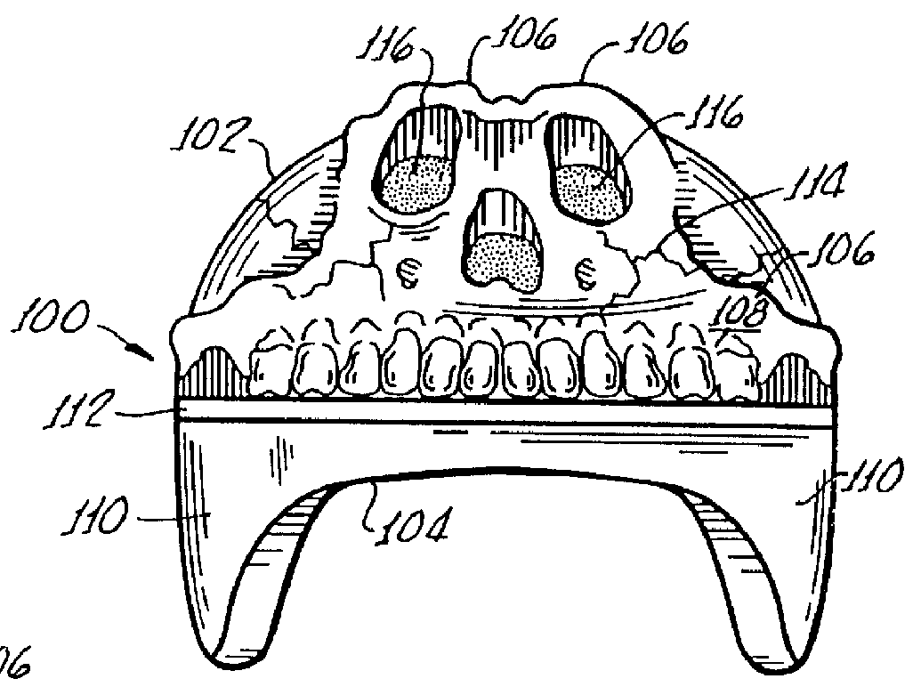 Helmet having improved safety features