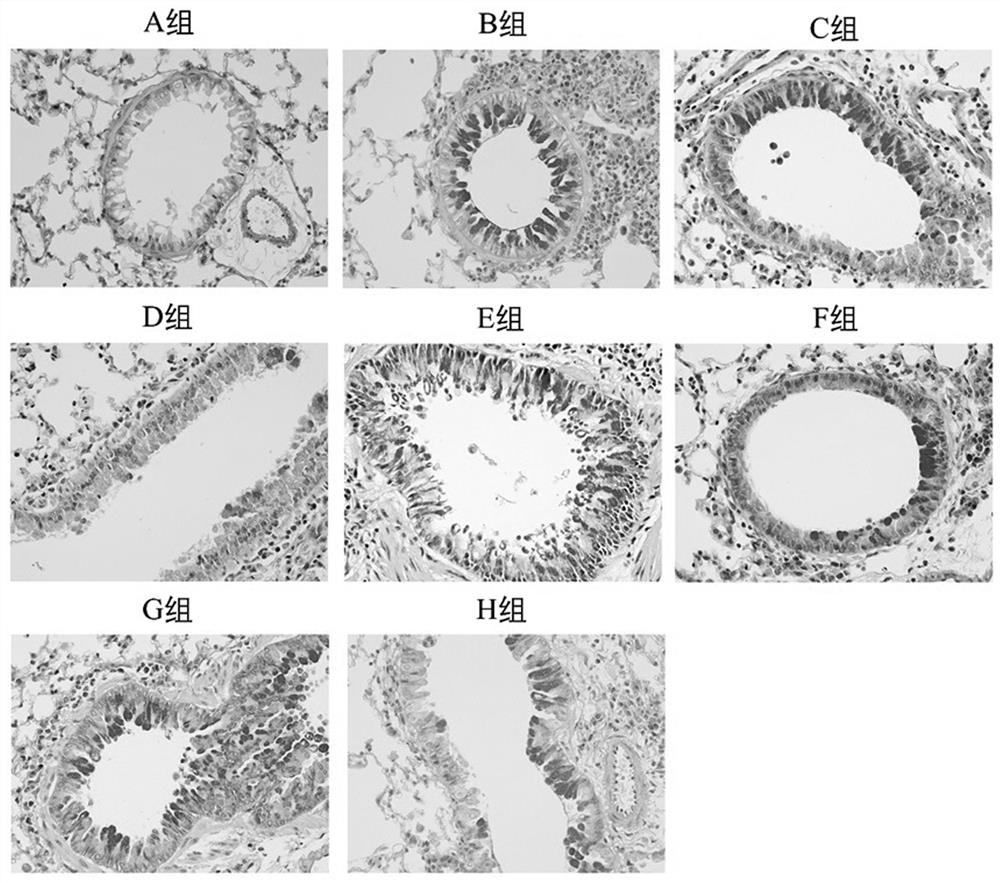 Thermal inactivation clostridium butyricum for preventing or treating asthma and preparation method of thermal inactivation clostridium butyricum