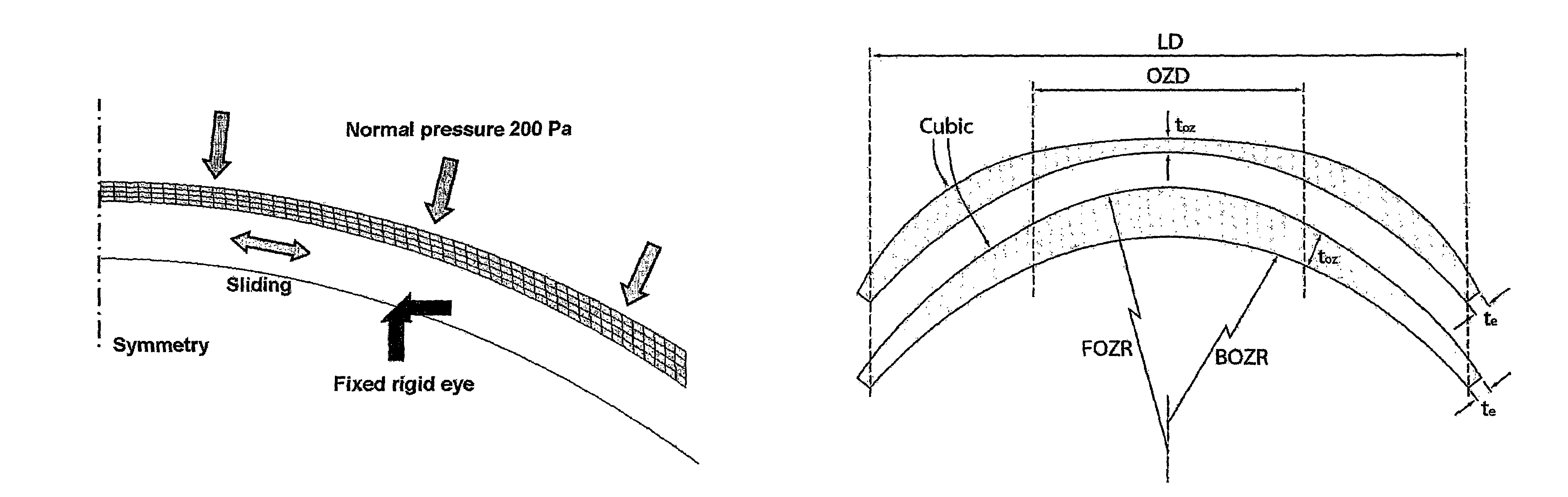 Soft lens orthokeratology