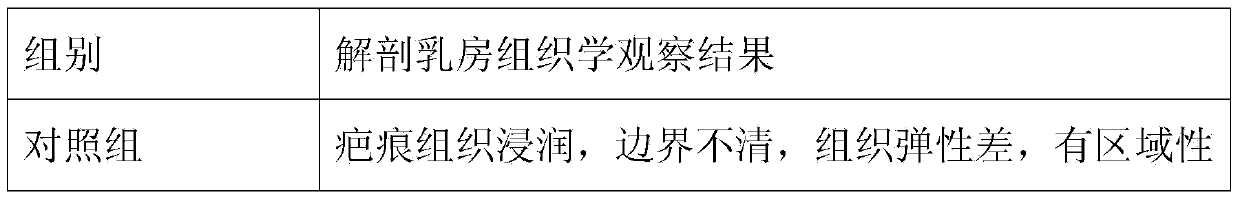 Long-acting cloxacillin benzathine breast injectant and preparation method thereof