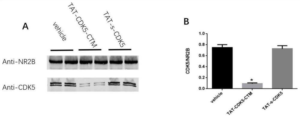 A kind of small molecule polypeptide and its application in preparing medicine for preventing and treating ischemic stroke