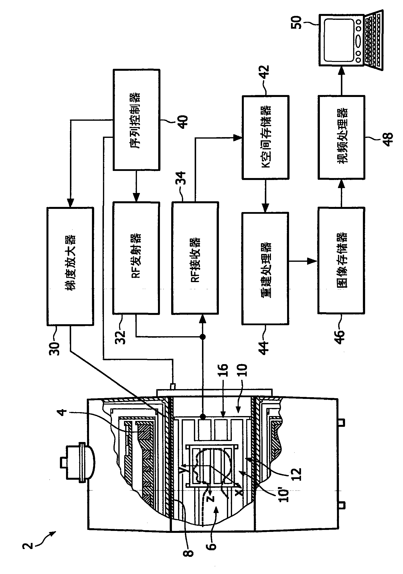 Birdcage coil with improved homogeneity and reduced SAR