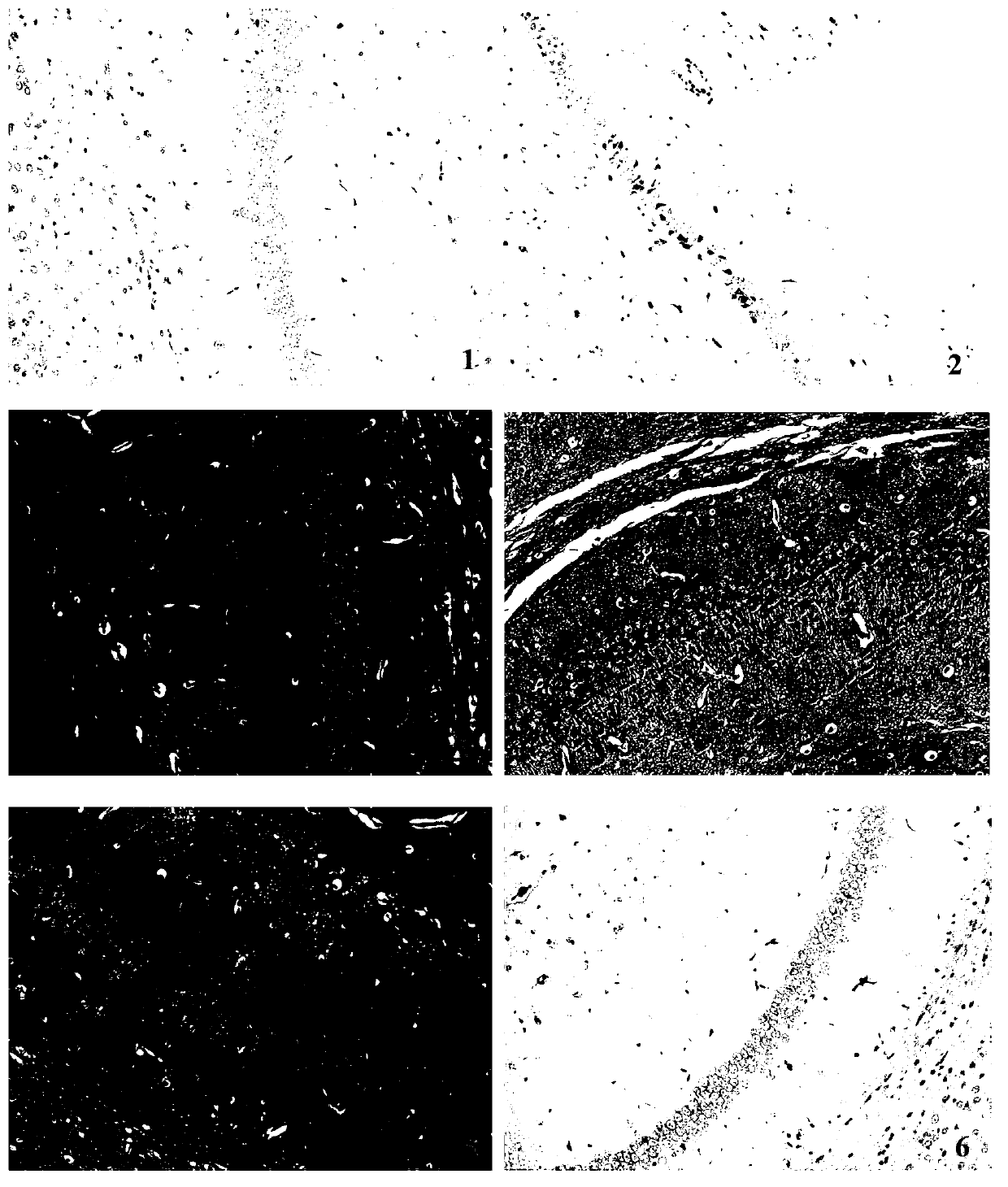 Application of mental treasure pills in preparation of medicine for treating senile dementia