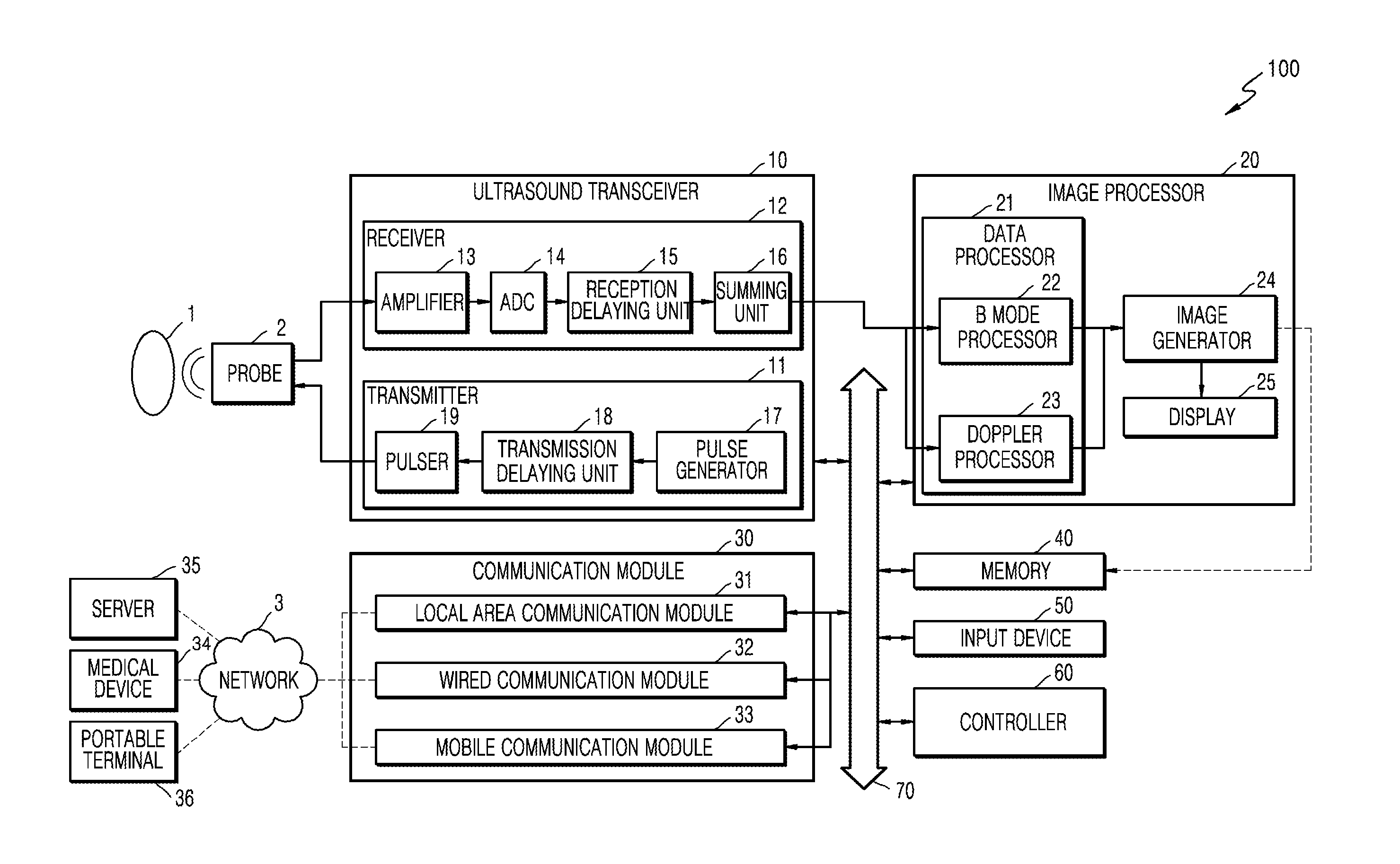 Ultrasound diagnosis apparatus