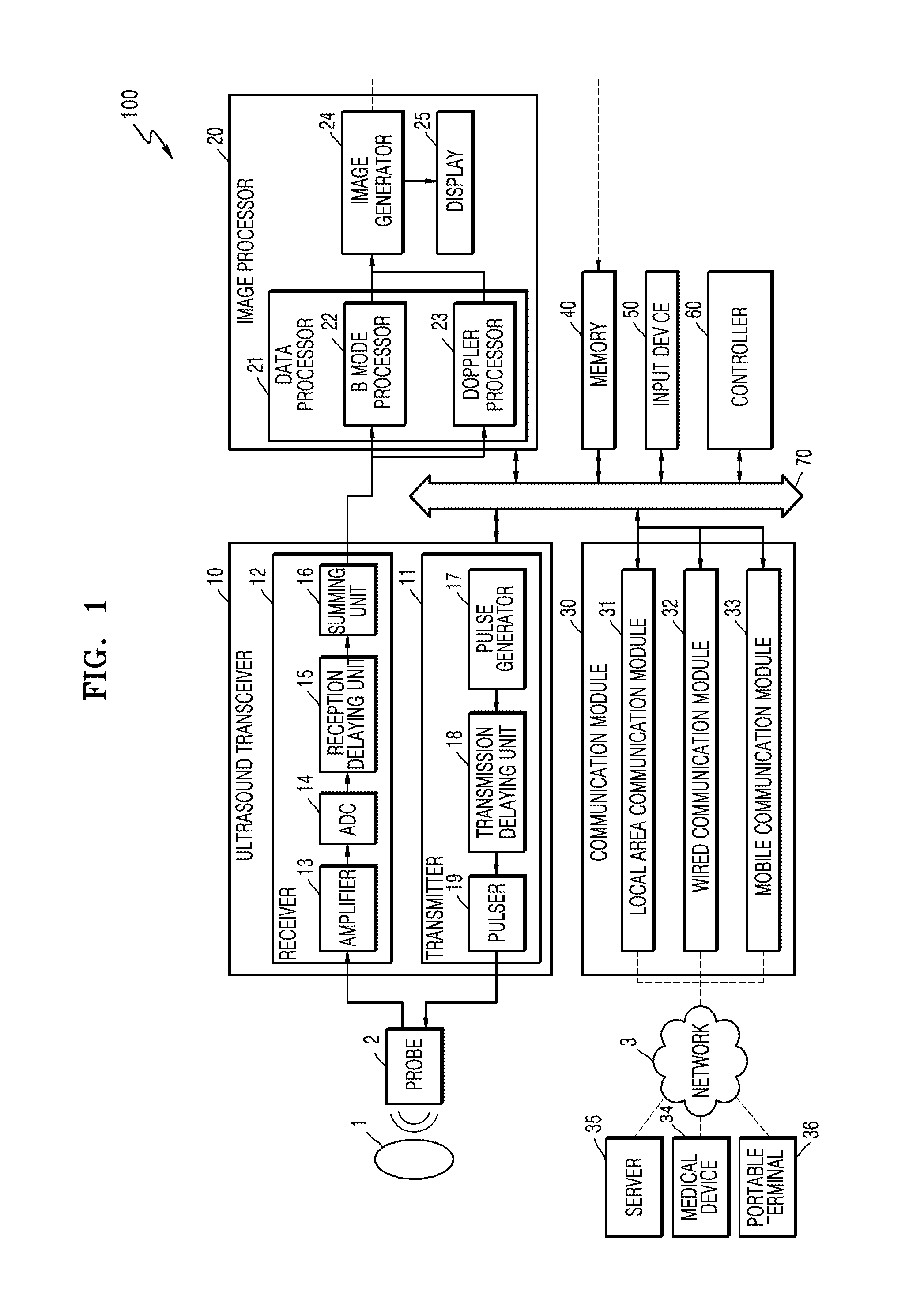 Ultrasound diagnosis apparatus