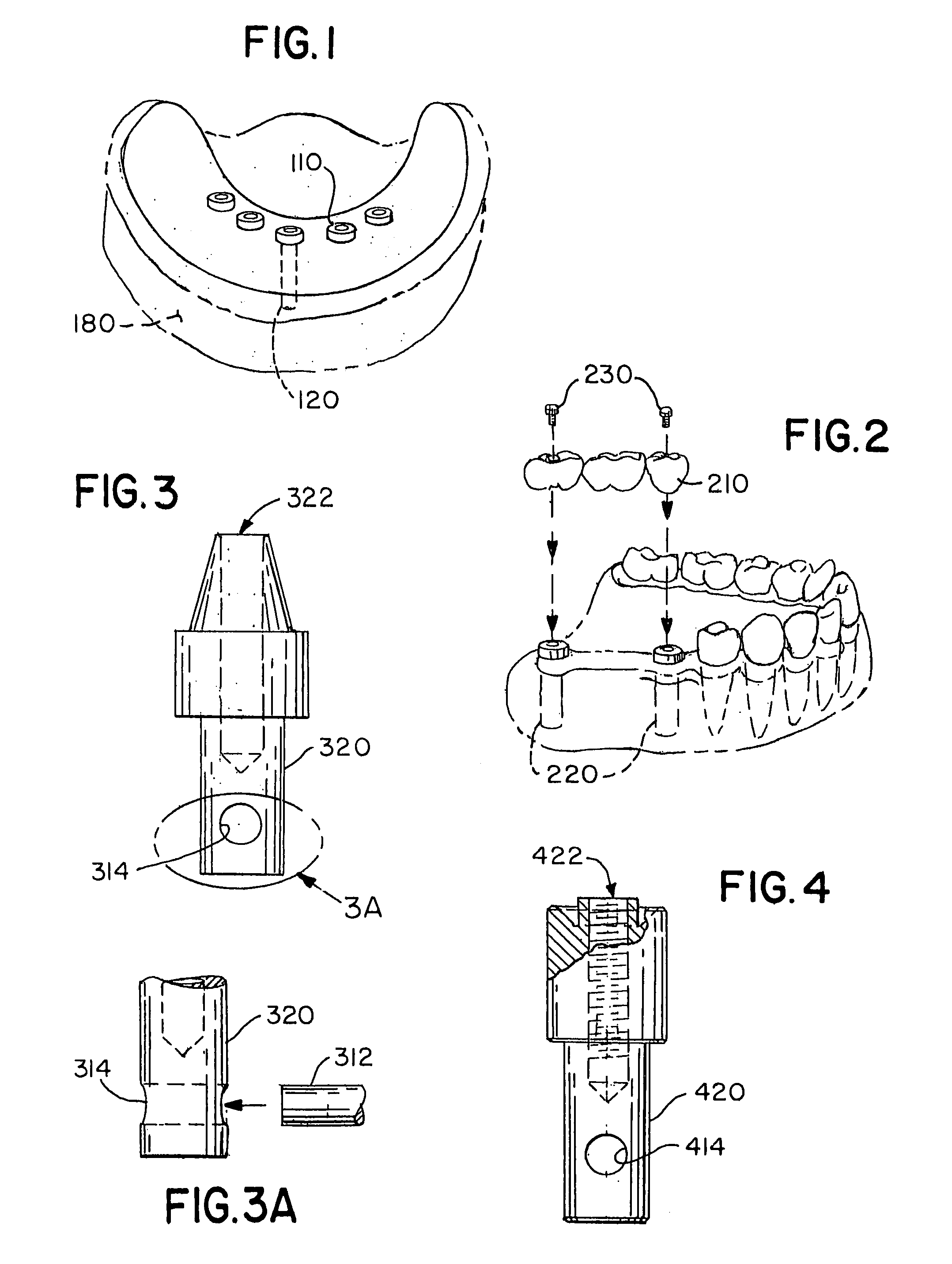 Stable dental analog