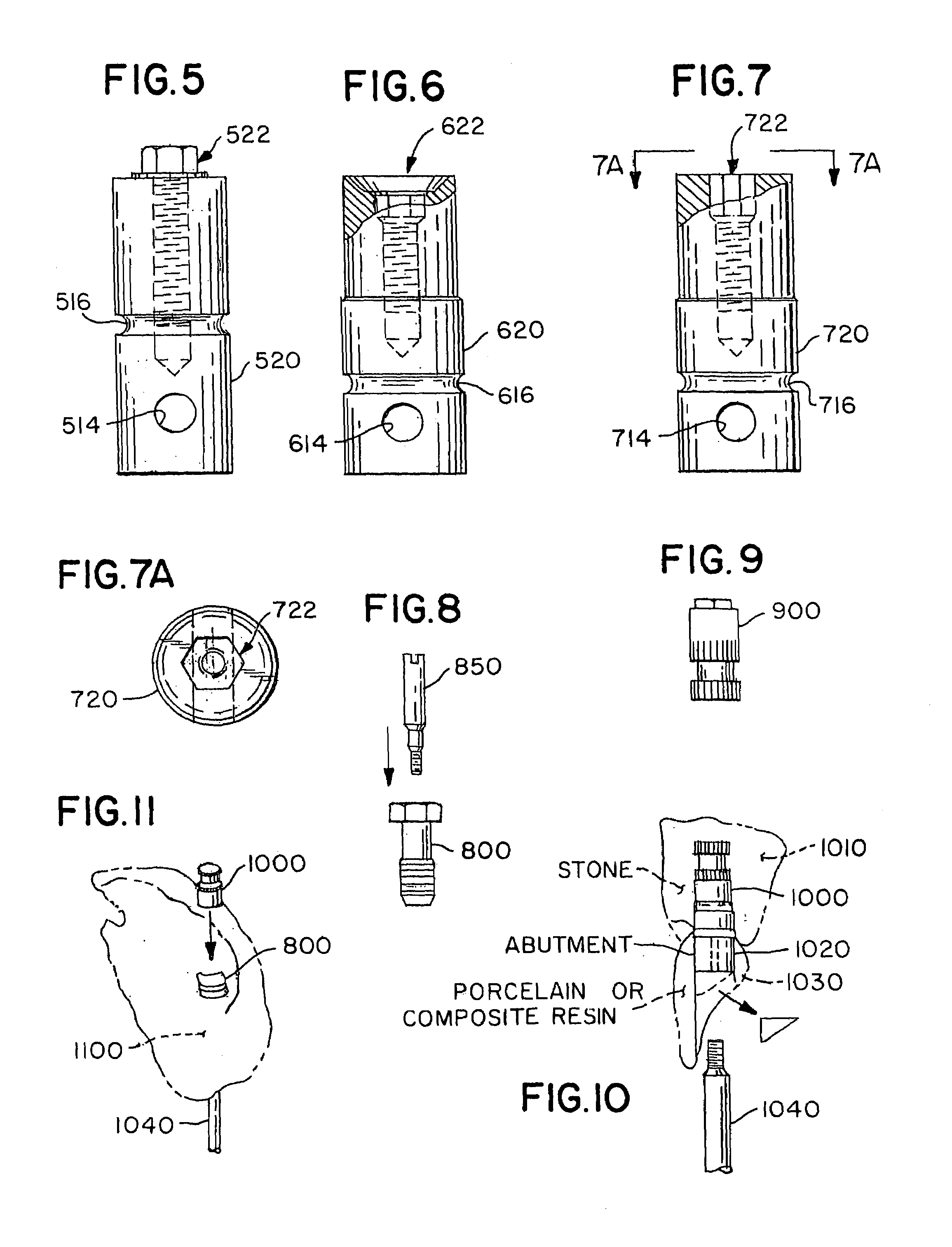 Stable dental analog