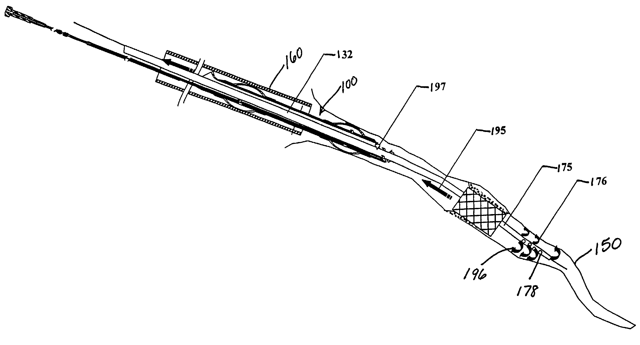 Emboli protection devices and related methods of use