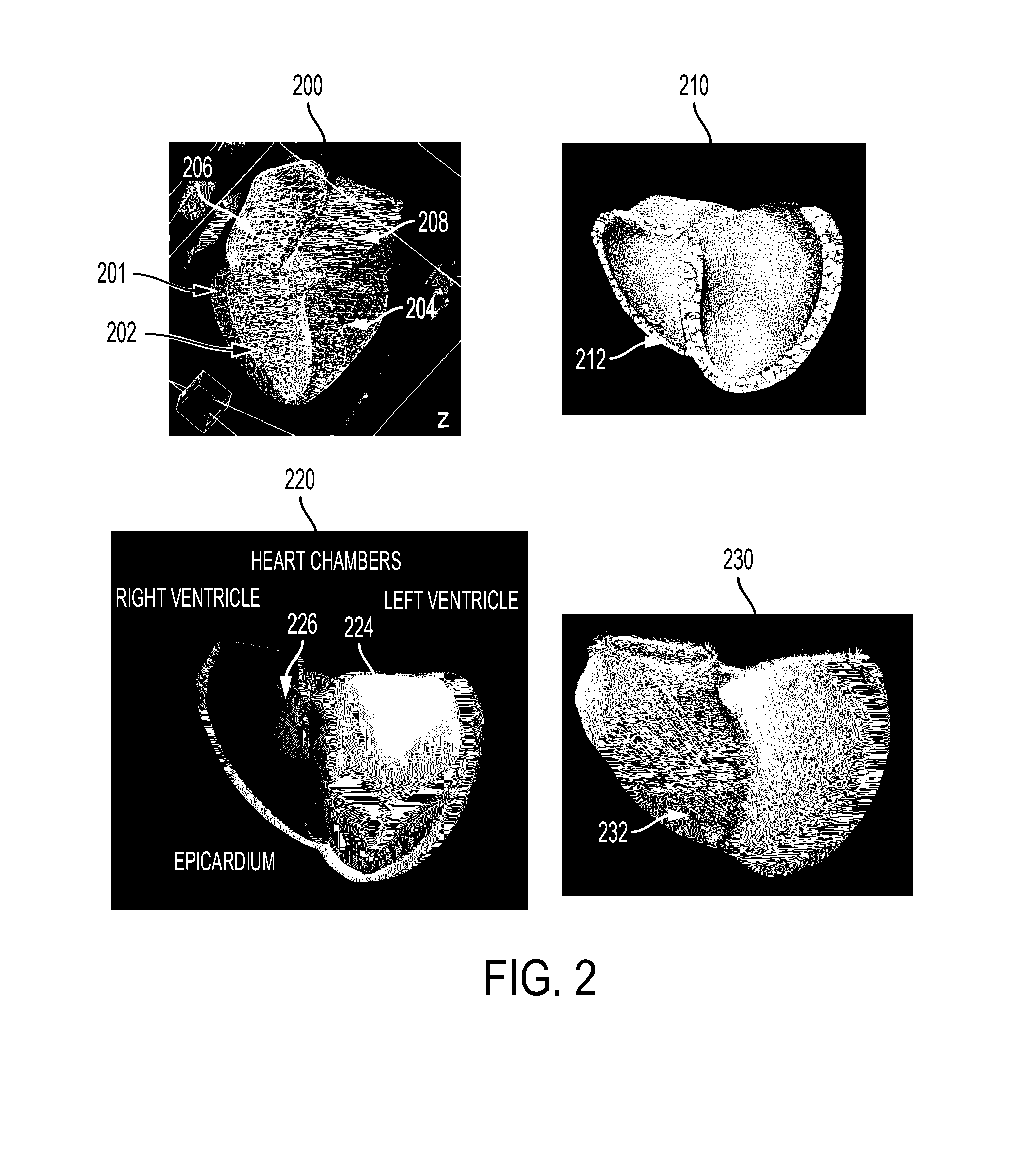 System and Method for Non-Invasively Estimating Electrophysiological Maps and Measurements from Cardio-Thoracic 3D Images and Electrocardiography Data