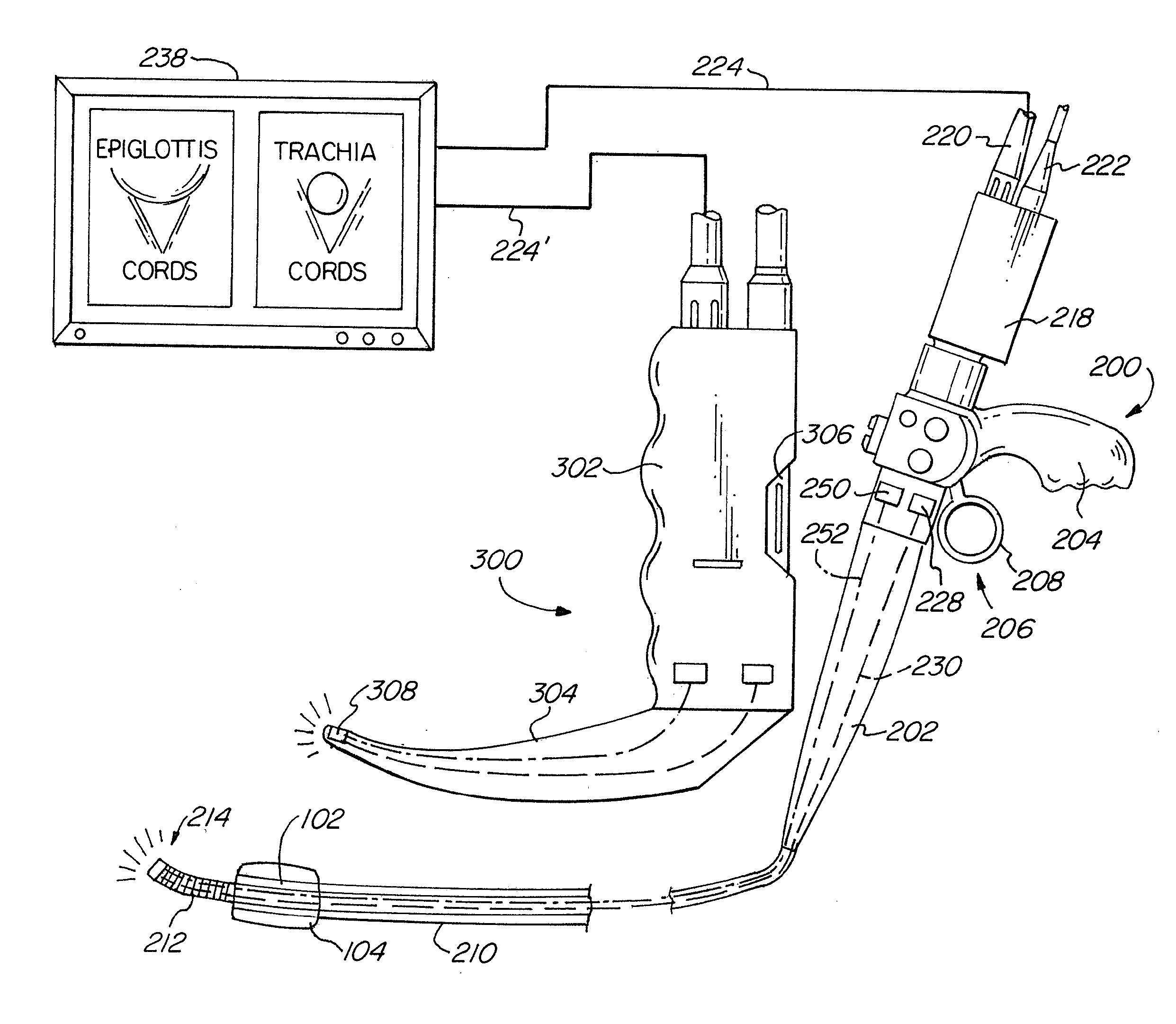 Simultaneous Display Video Laryngoscope And Video Stylet