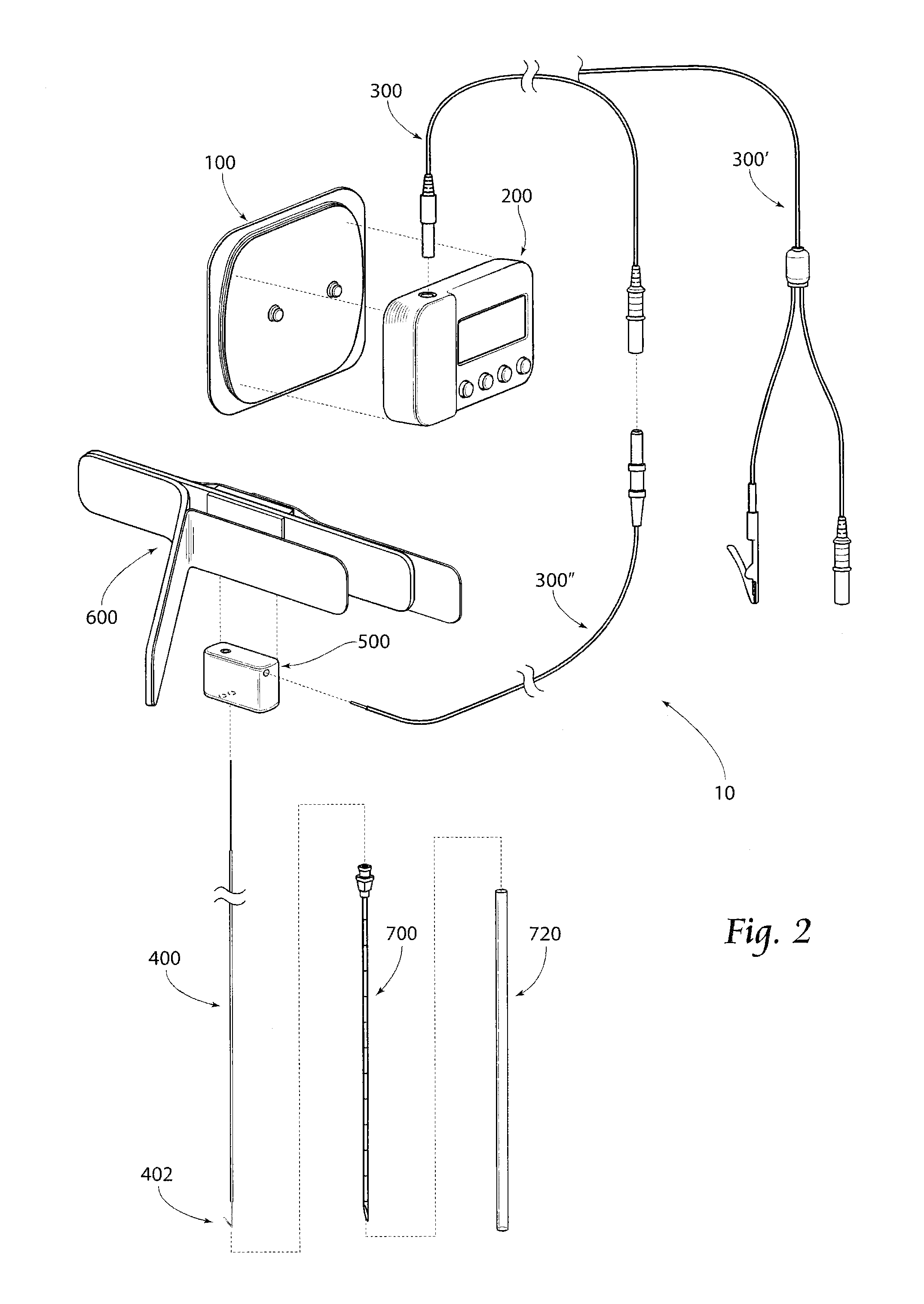 System and method for treating shoulder pain related to subacromial impingement syndrome