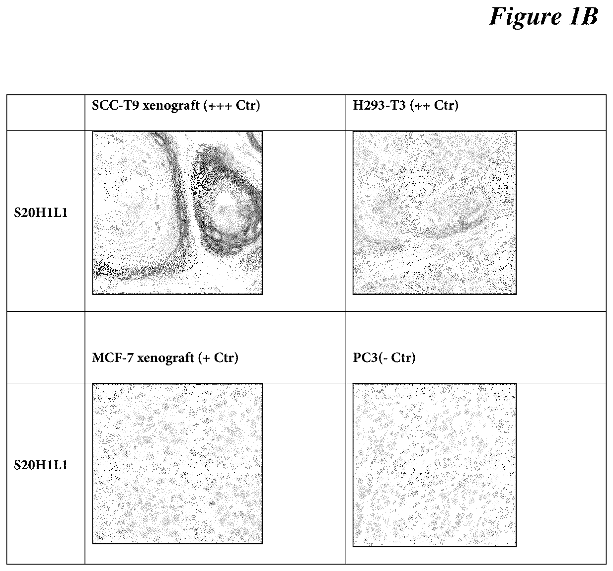 Antibodies, compositions, and immunohistochemistry methods for detecting C4.4a