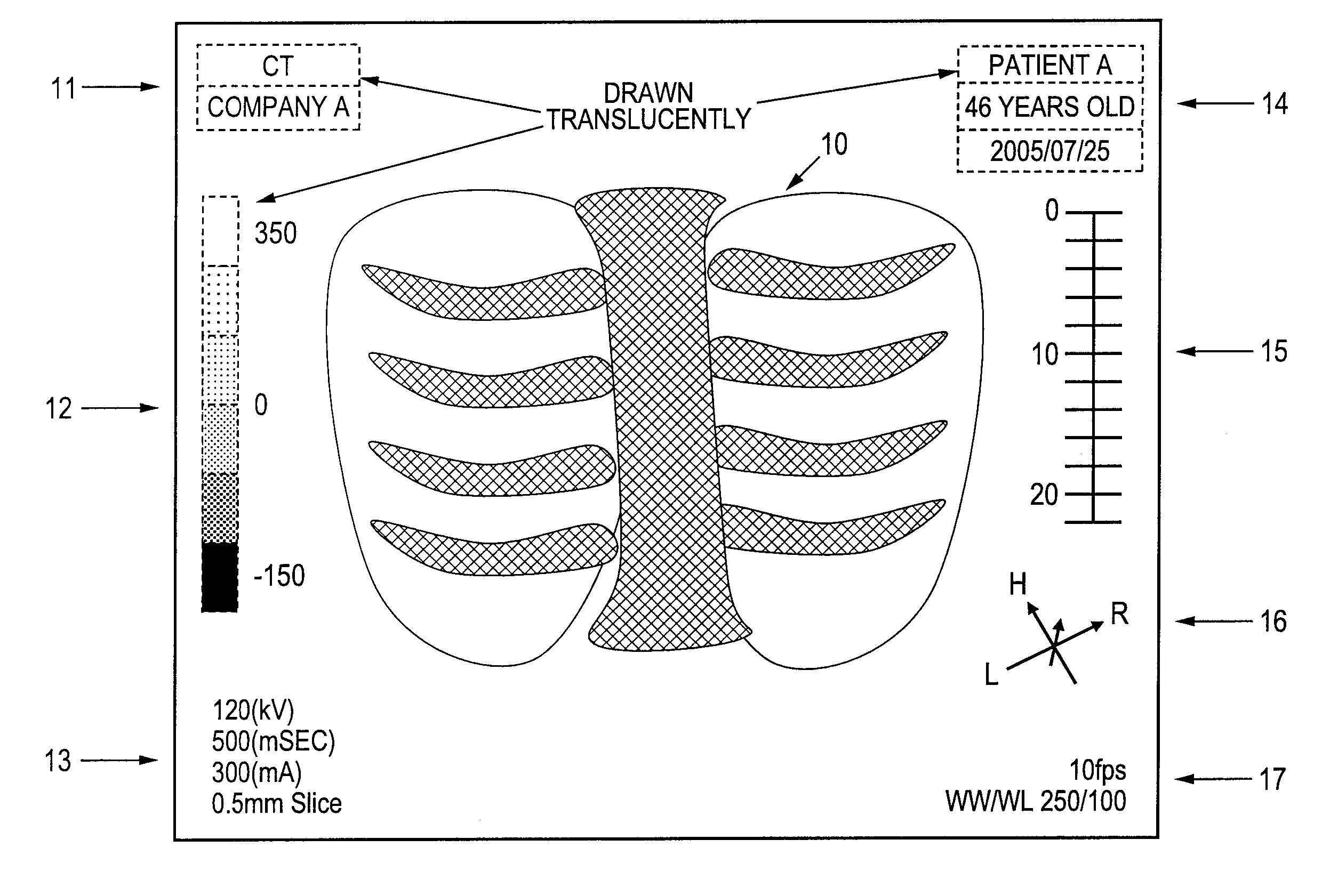 Image processing method and computer readable medium for image processing