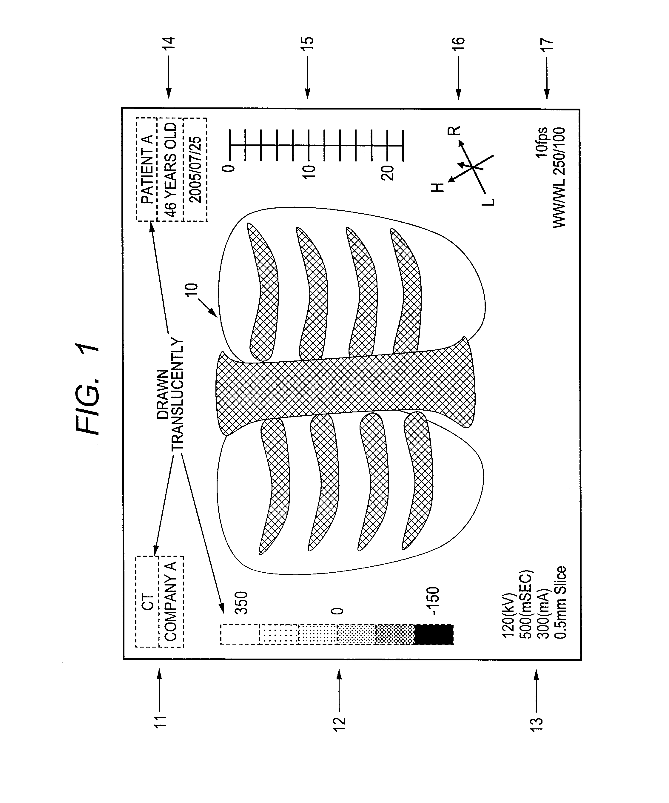 Image processing method and computer readable medium for image processing