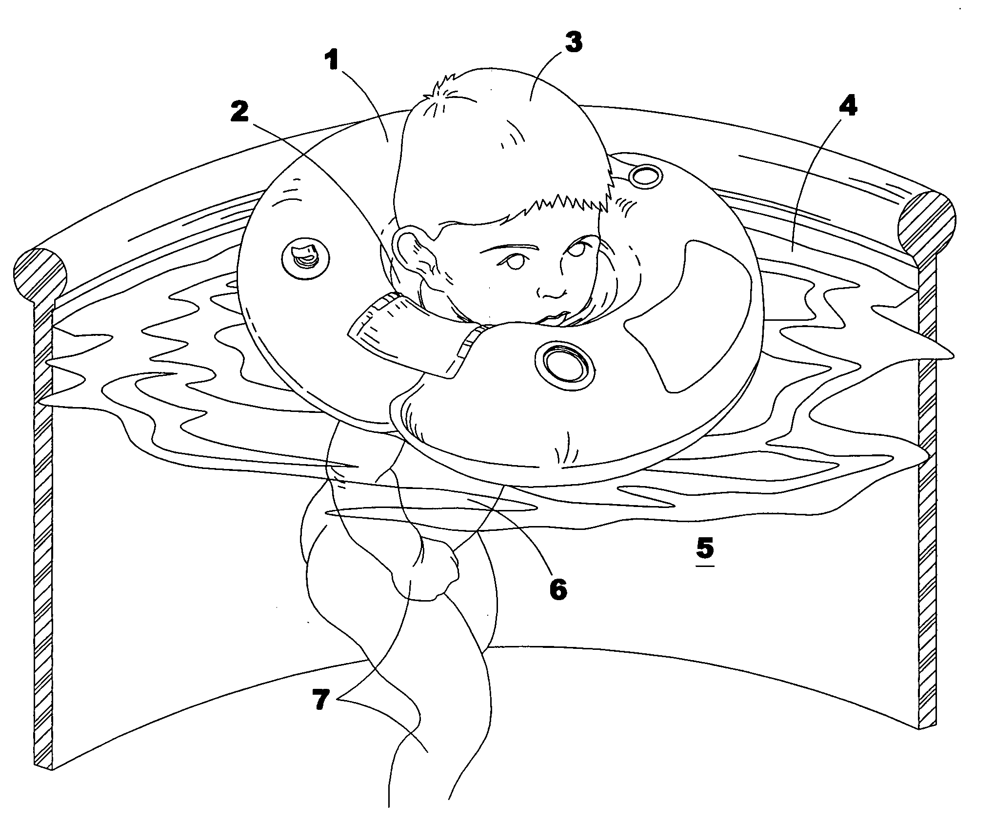 Method for treatment of infants with developmental delay