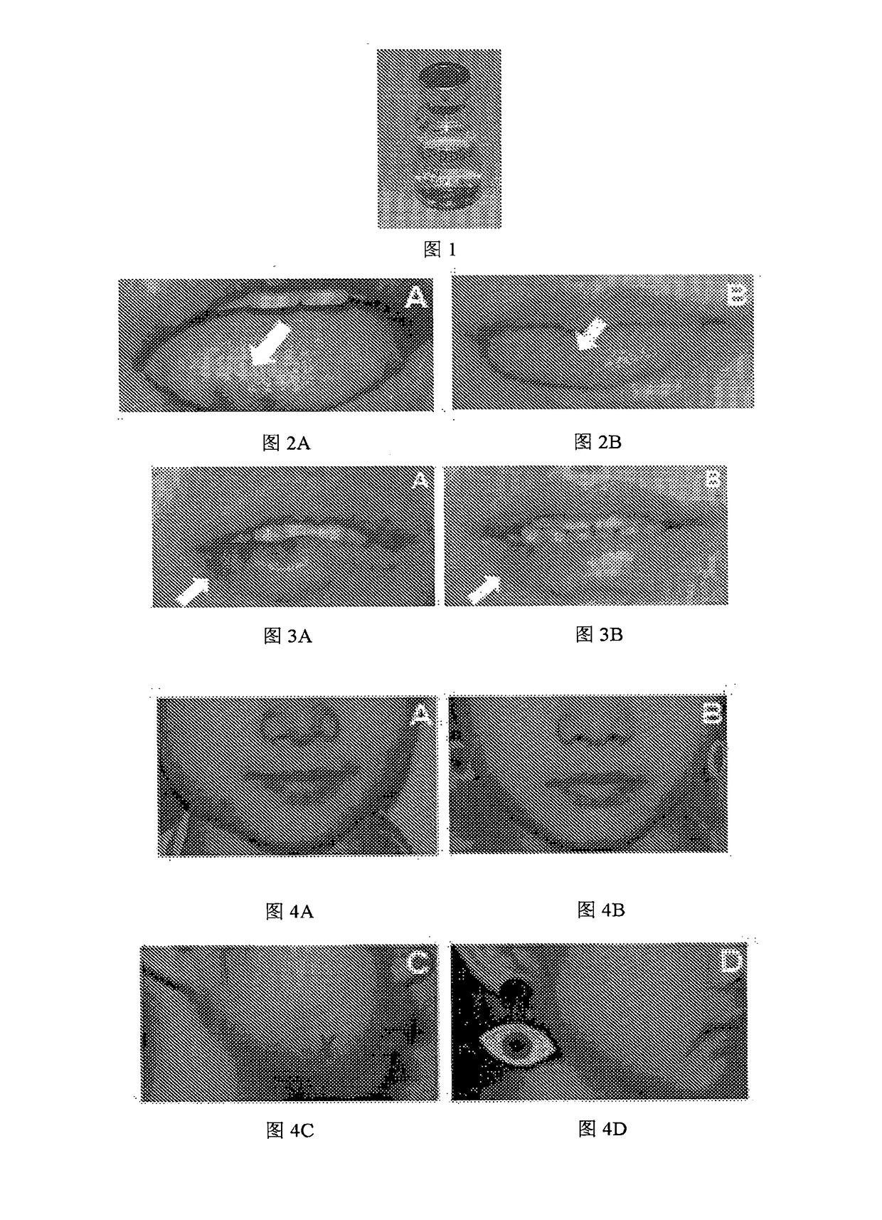 Pharmaceutical composition for Anti-vascular diseases and Anti-tumor and use thereof