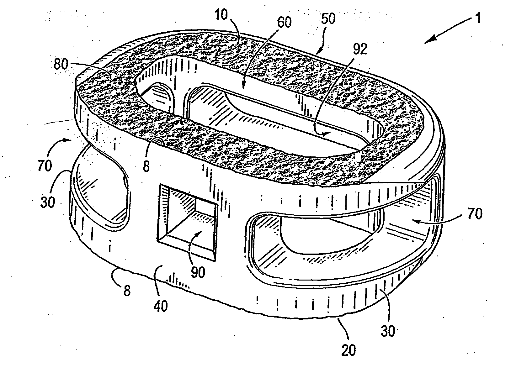 Spinal implant and integration plate for optimizing vertebral endplate contact load-bearing edges