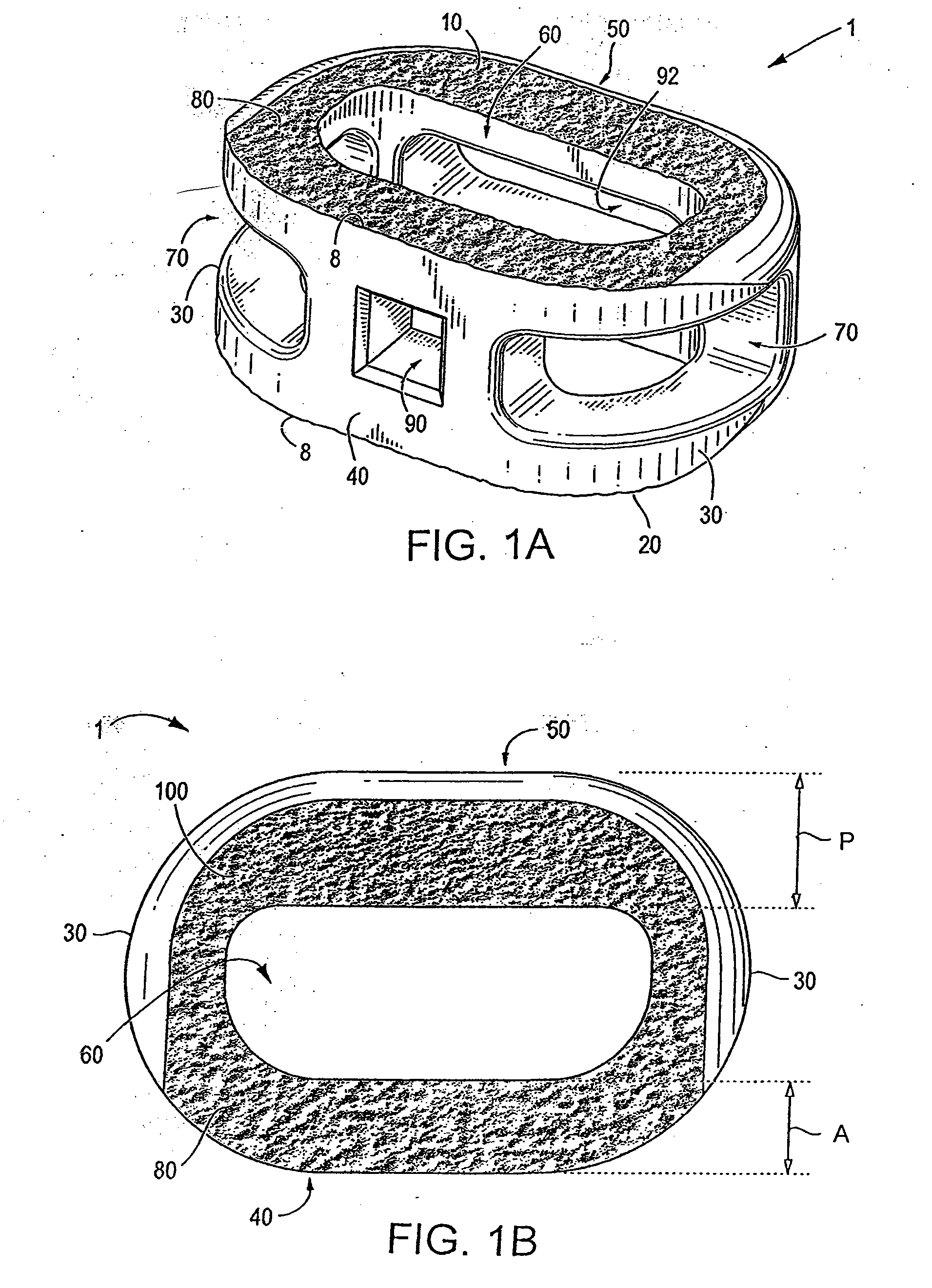 Spinal implant and integration plate for optimizing vertebral endplate contact load-bearing edges