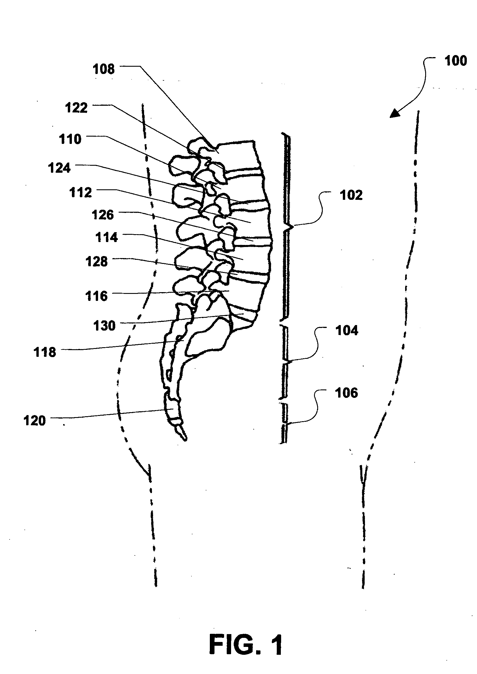 Passive lubricating prosthetic joint