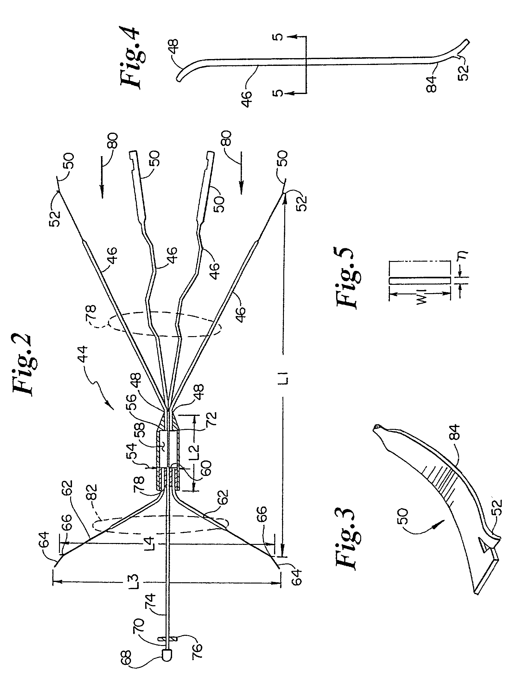 Atraumatic anchoring and disengagement mechanism for permanent implant device