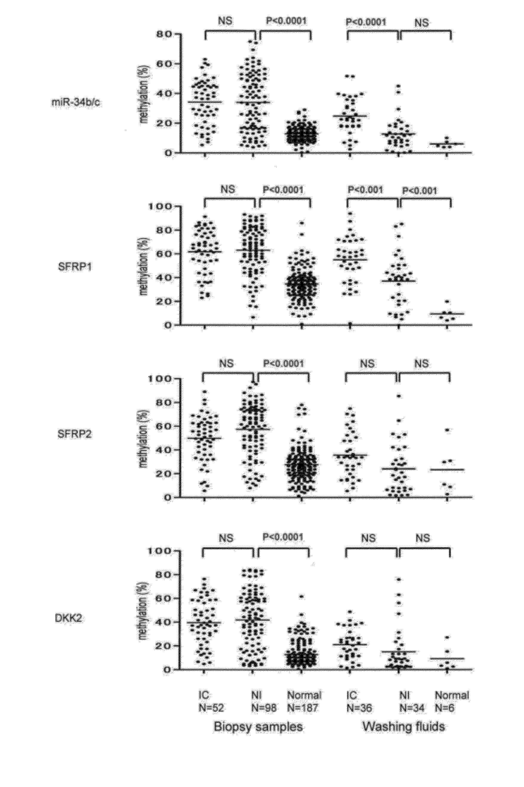 Specimen for detecting infiltrative large intestine tumors