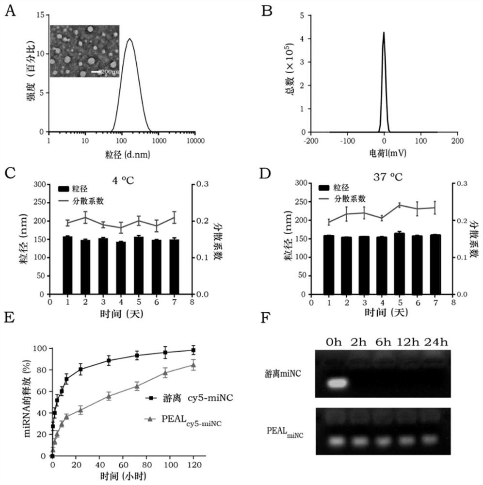 Drug-loaded delivery drug delivery system for treating systemic lupus erythematosus and preparation method thereof