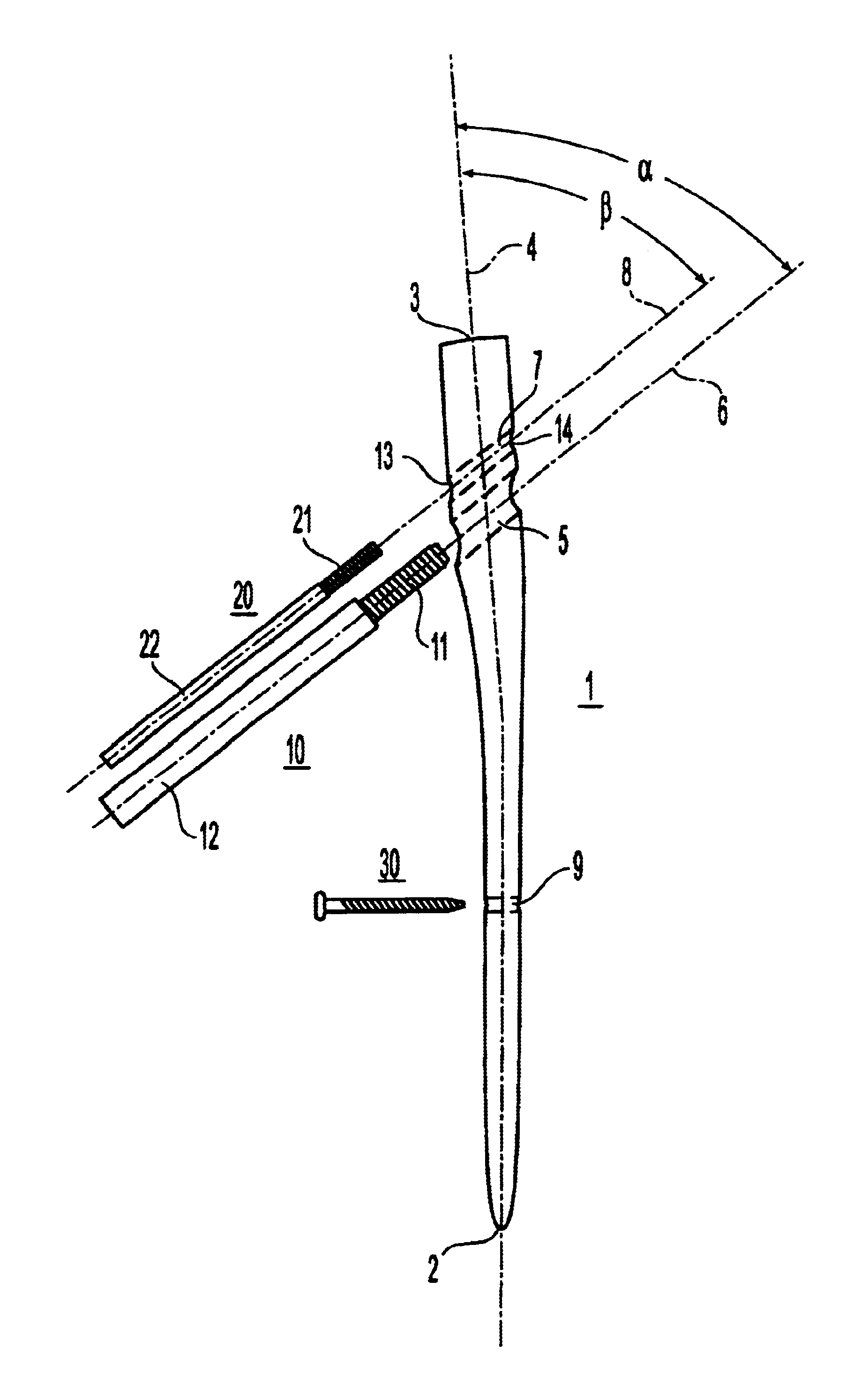 Intramedullary nail