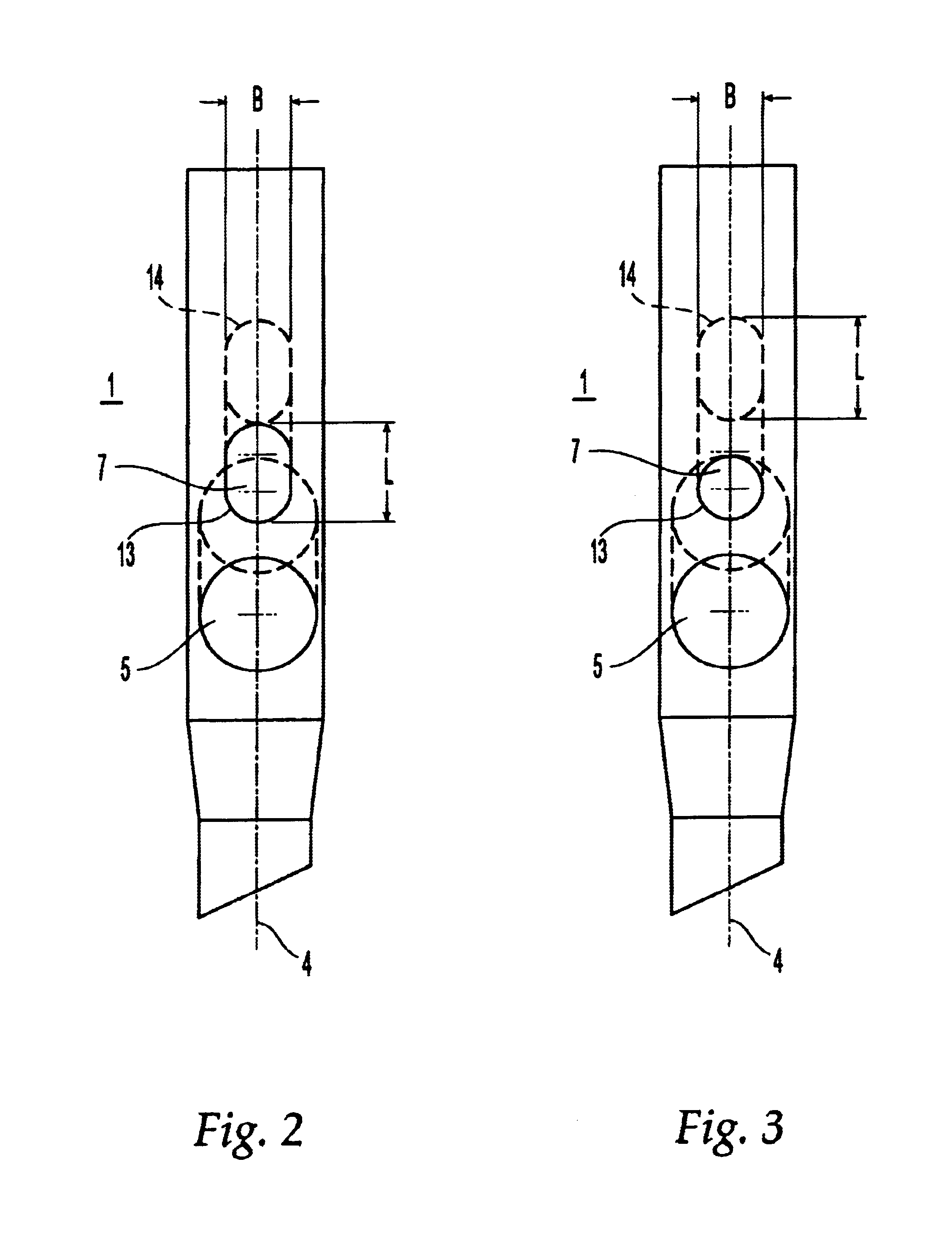 Intramedullary nail