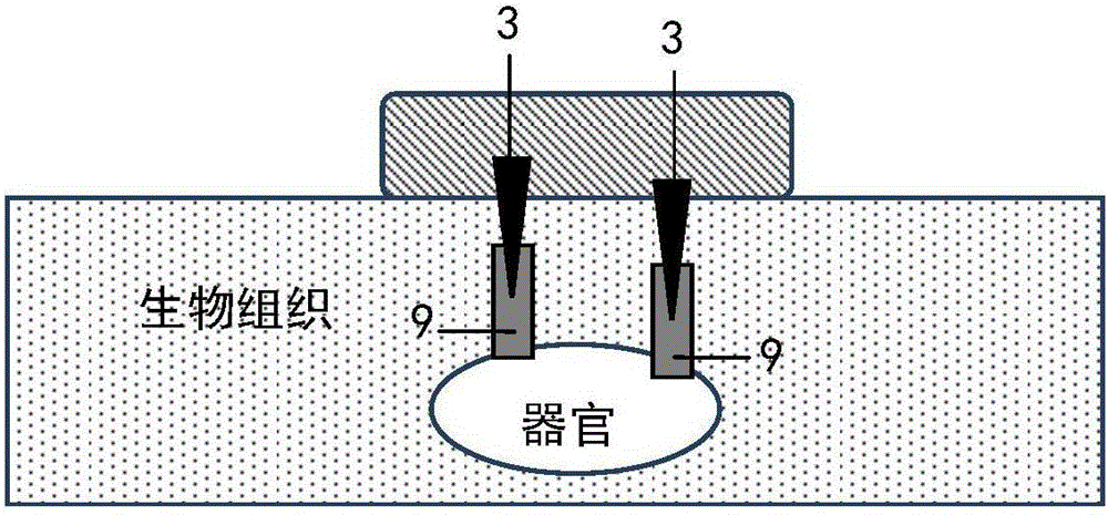 Implantation-attachment type electrical stimulation device