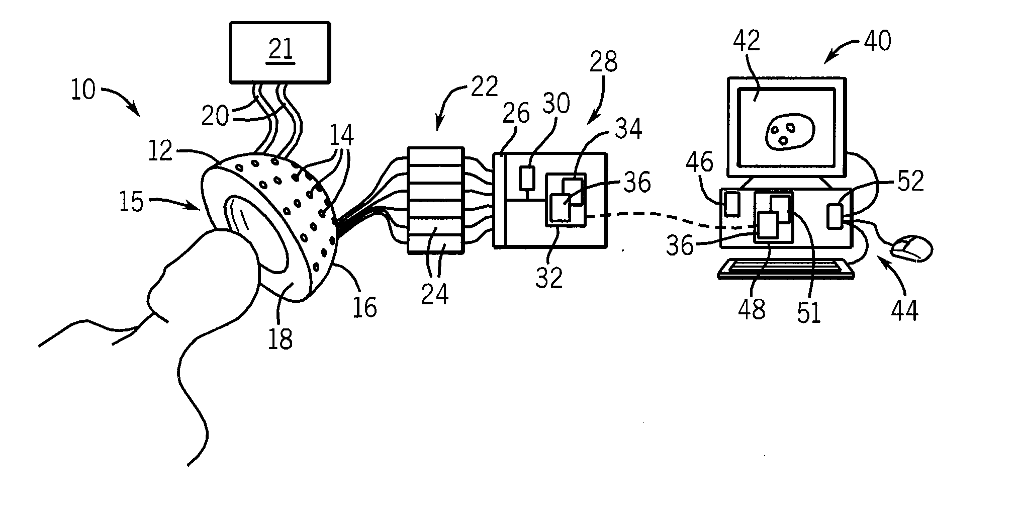 Microwave Hyperthermia Treatment System