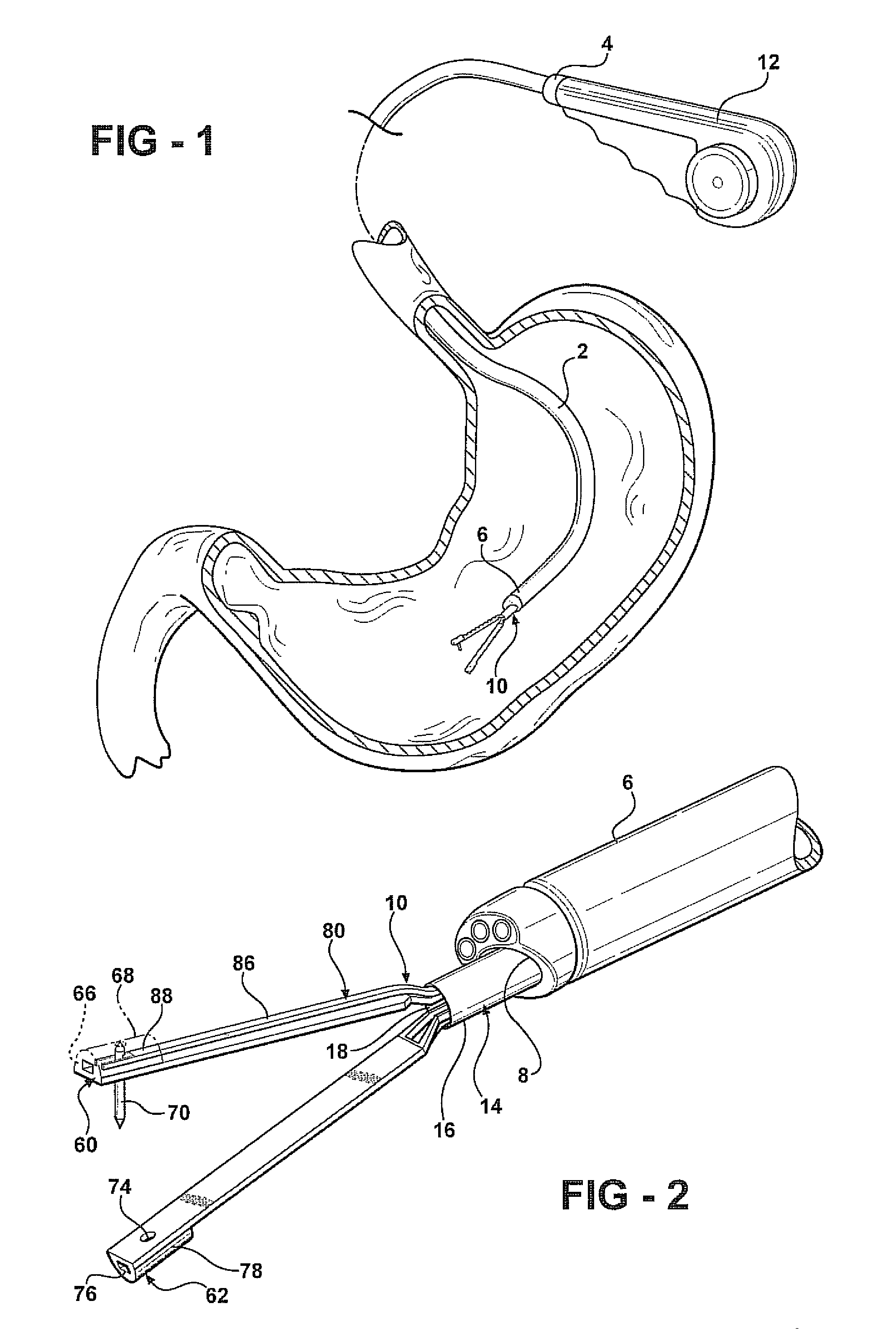 Endosurgery suturing device