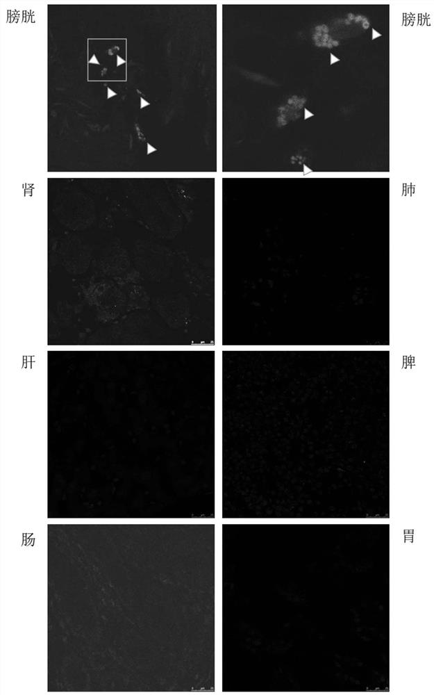 Bladder targeted drug-loaded exosome and application as well as drug for treating bladder diseases