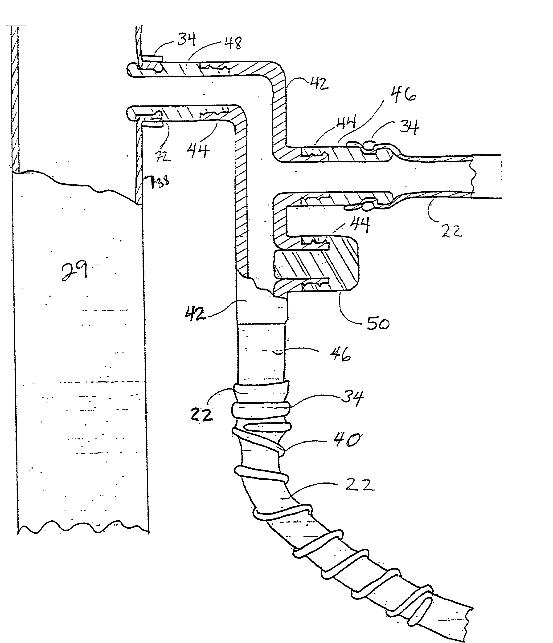 Sutureless anastomosis systems