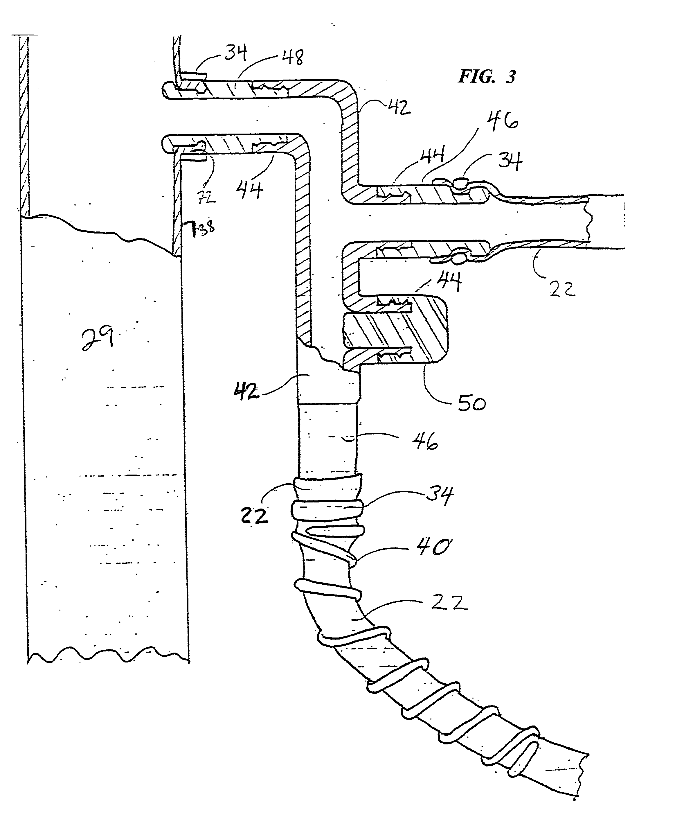 Sutureless anastomosis systems