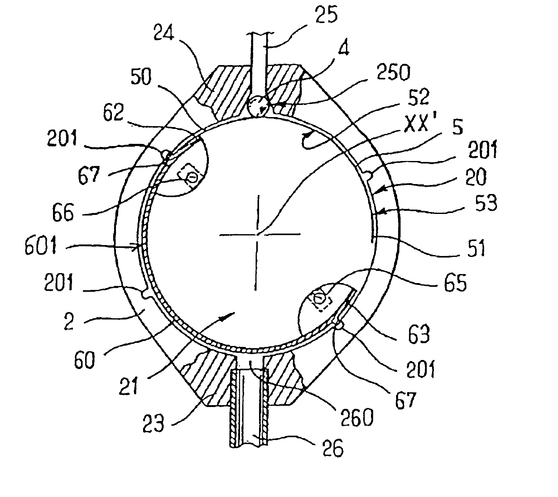 Implantable subcutaneous valve for the treatment of hydrocephalus, and adjusting devices therefor