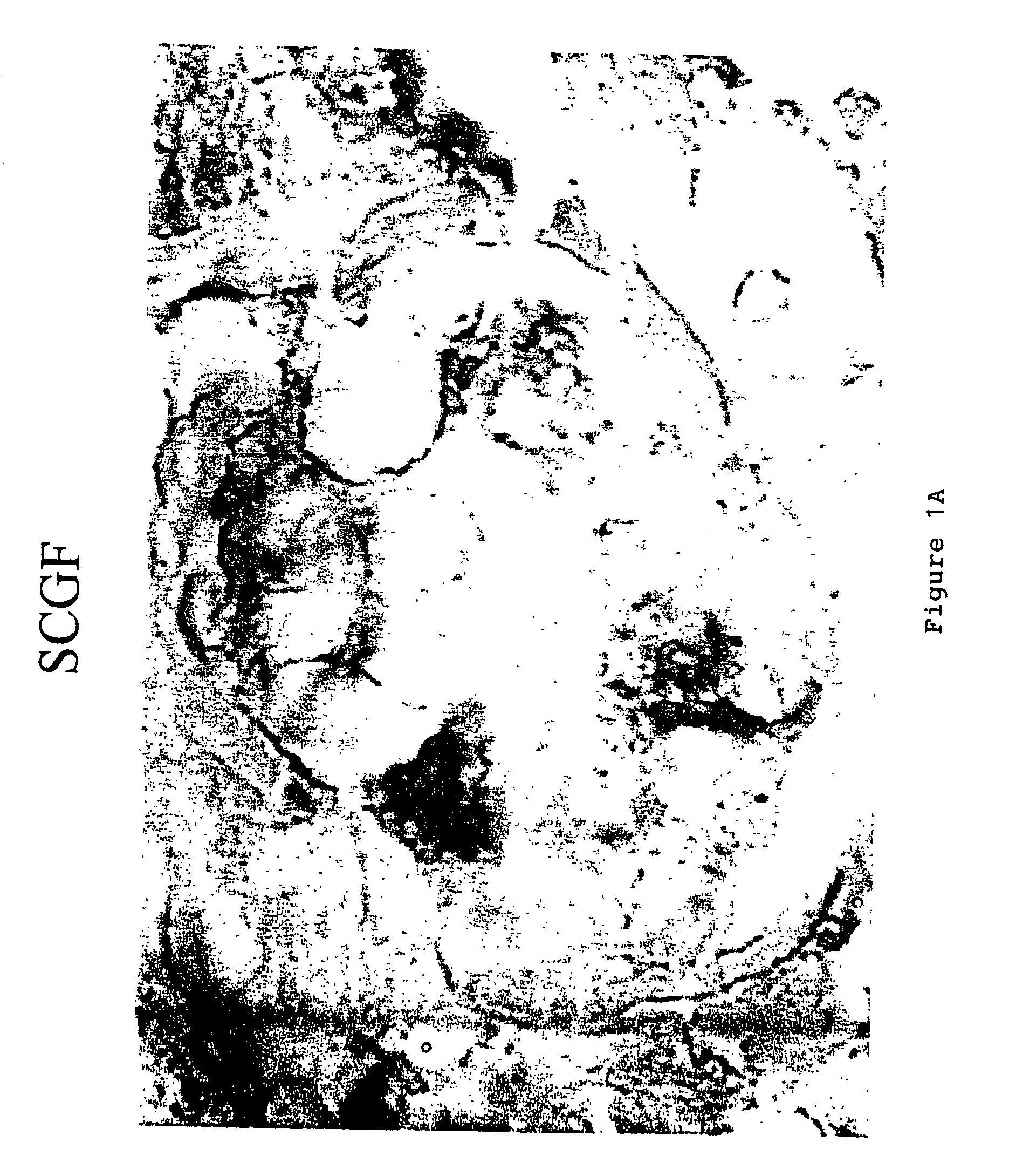 Method and quantification assay for determining c-kit/SCF/pAKT status