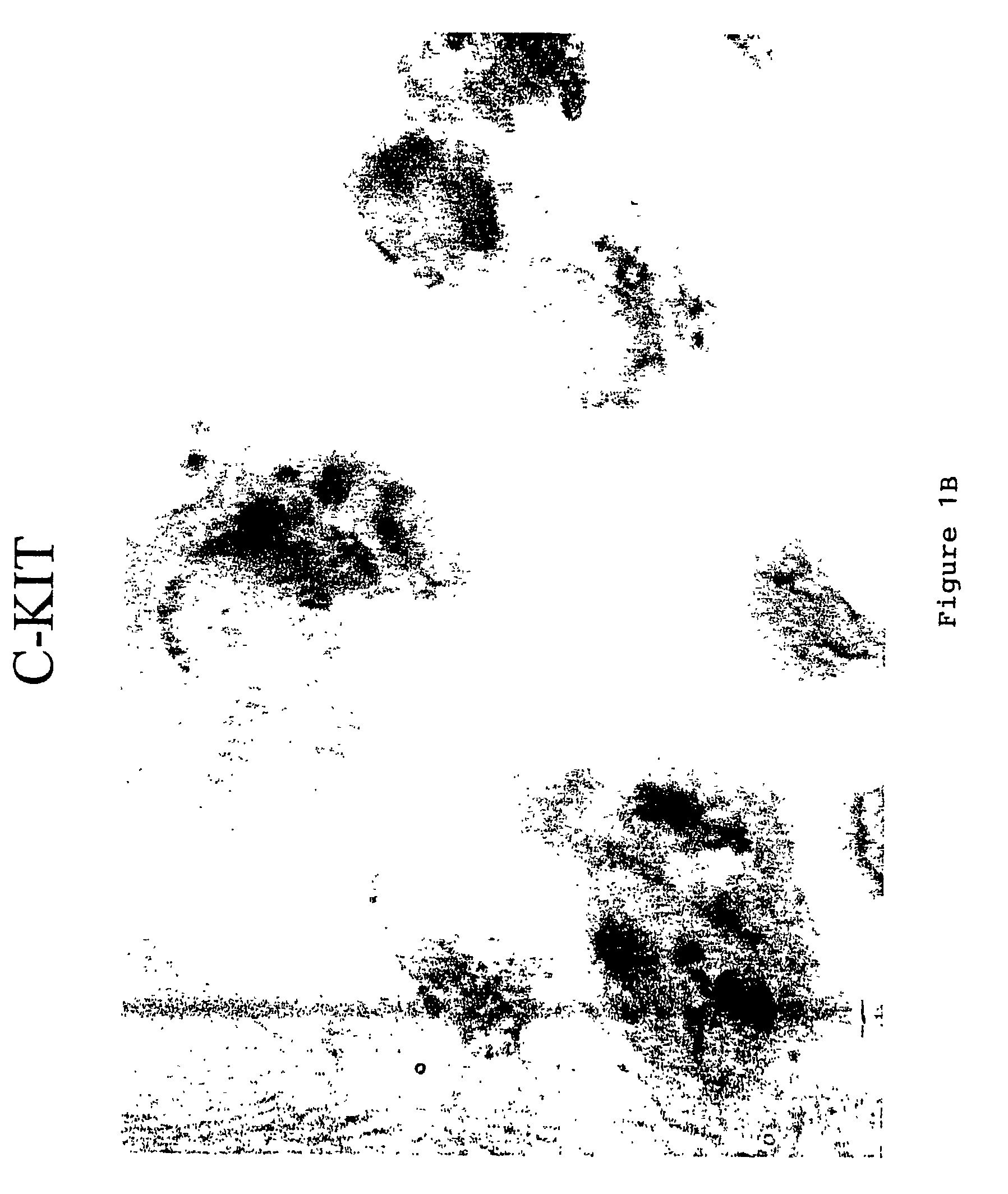 Method and quantification assay for determining c-kit/SCF/pAKT status