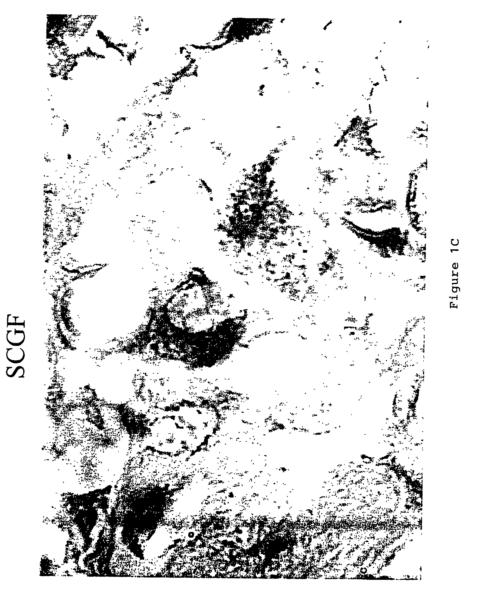 Method and quantification assay for determining c-kit/SCF/pAKT status