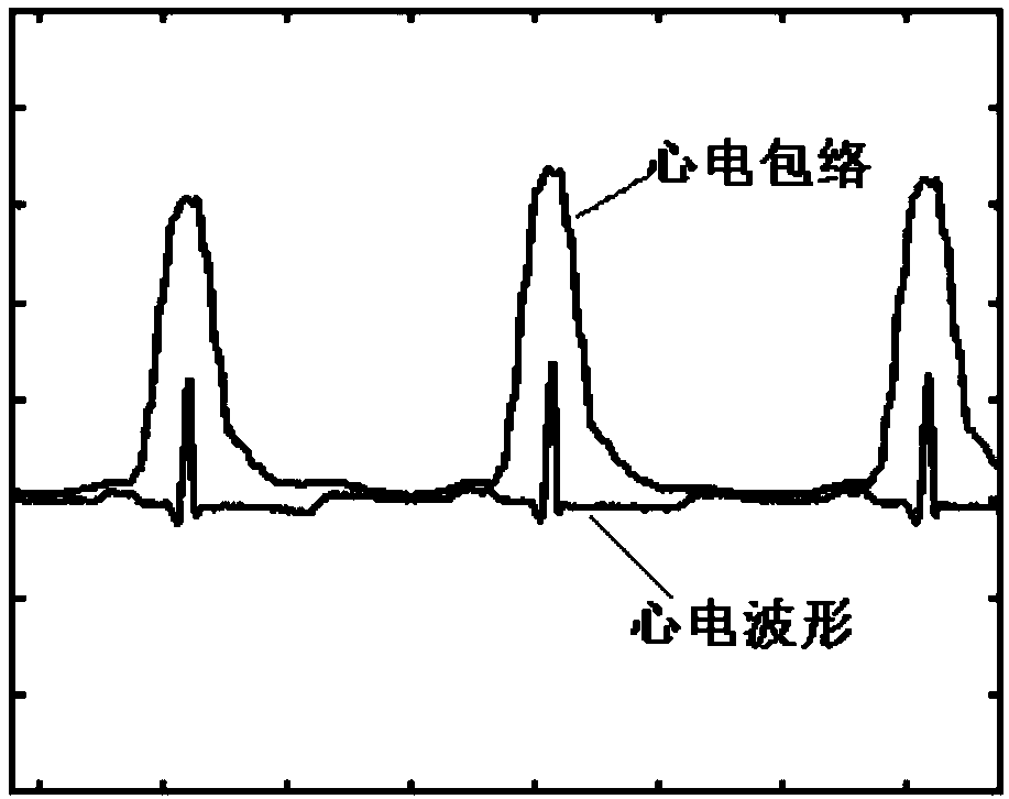 Method for detecting electrocardiogram QRS wave group width and electrocardiogram analysis method thereof