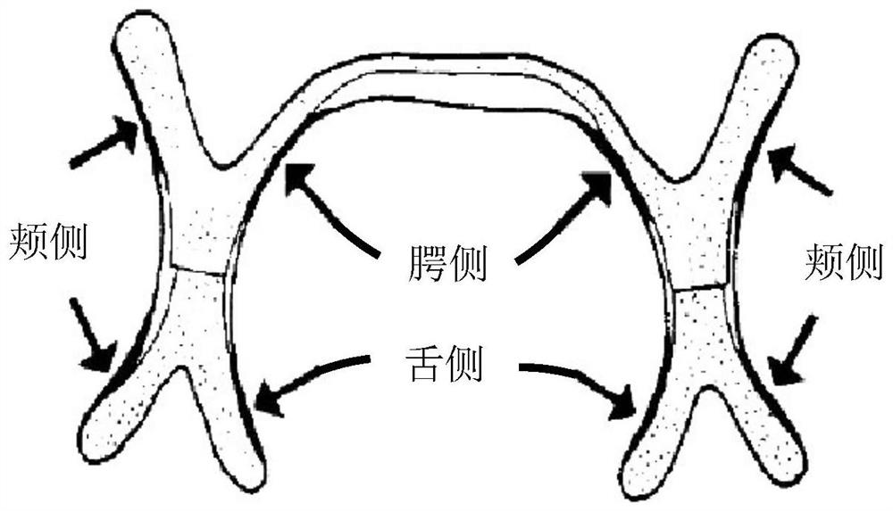 Semi-finished complete denture based on manufactured artificial dentition structure and rapid manufacturing method of complete denture