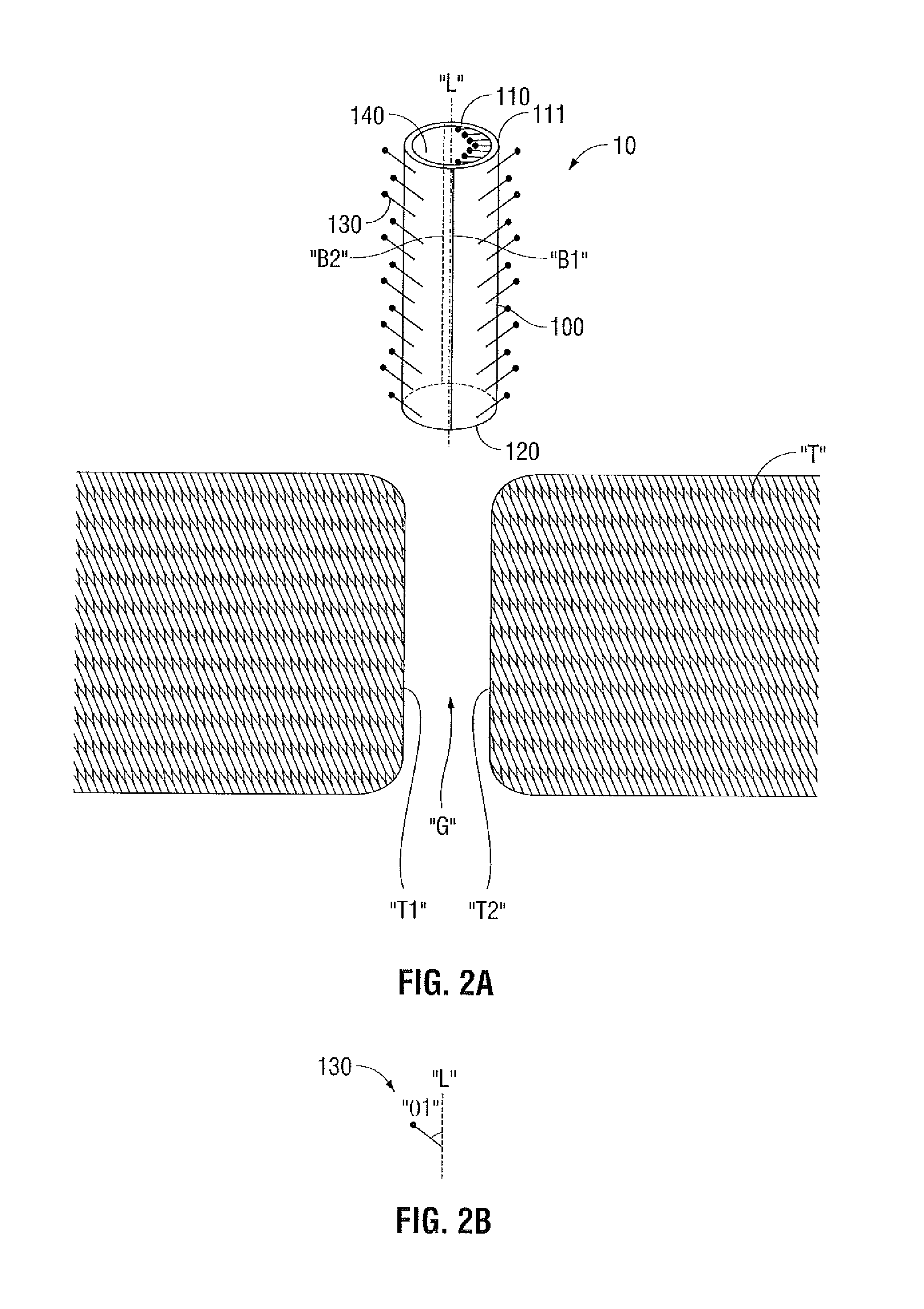 Wound closure device including progrip straw