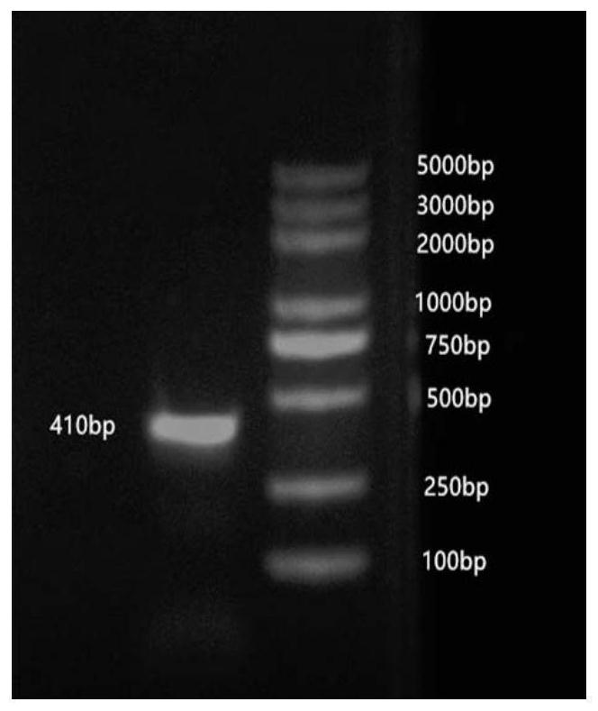 Anti-inflammatory polypeptide DAvp-1 in snake venom and application of anti-inflammatory polypeptide DAvp-1