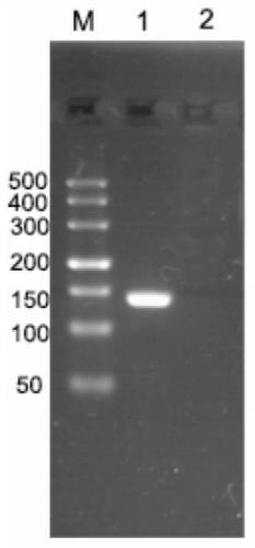 A primer, kit and detection method for detecting channel catfish virus using pyrosequencing technology